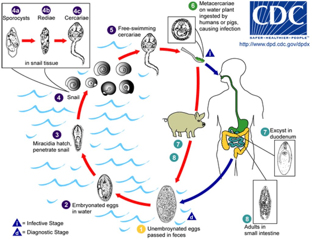 Causal Associations Between Remnant Cholesterol Levels and