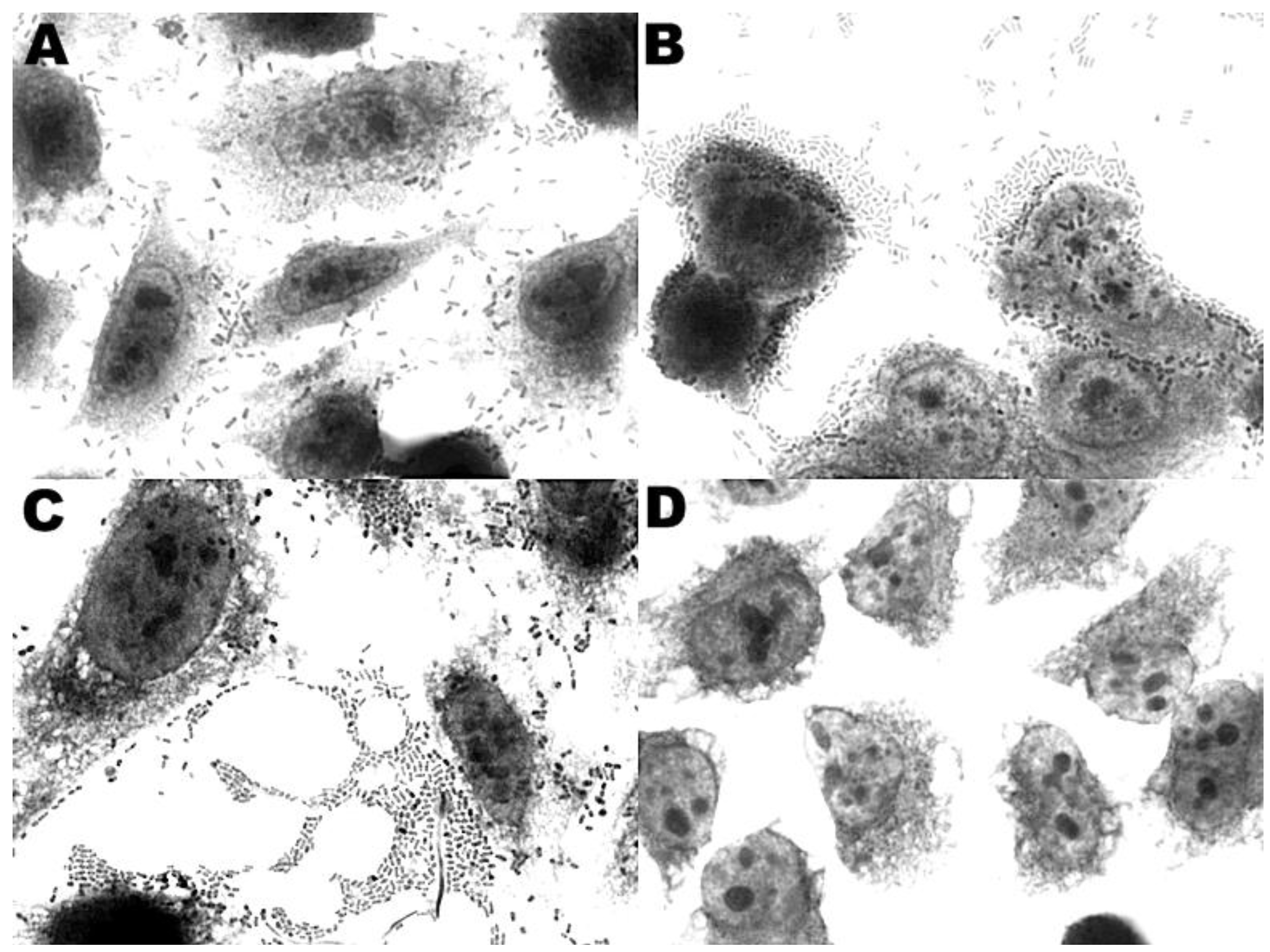 Ijerph Free Full Text Identification Of Diarrheagenic Escherichia Coli Strains From Avian Organic Fertilizers Html Ijerph Free Full Text Identification Of Diarrheagenic Escherichia Coli Strains From Avian Organic Fertilizers Html