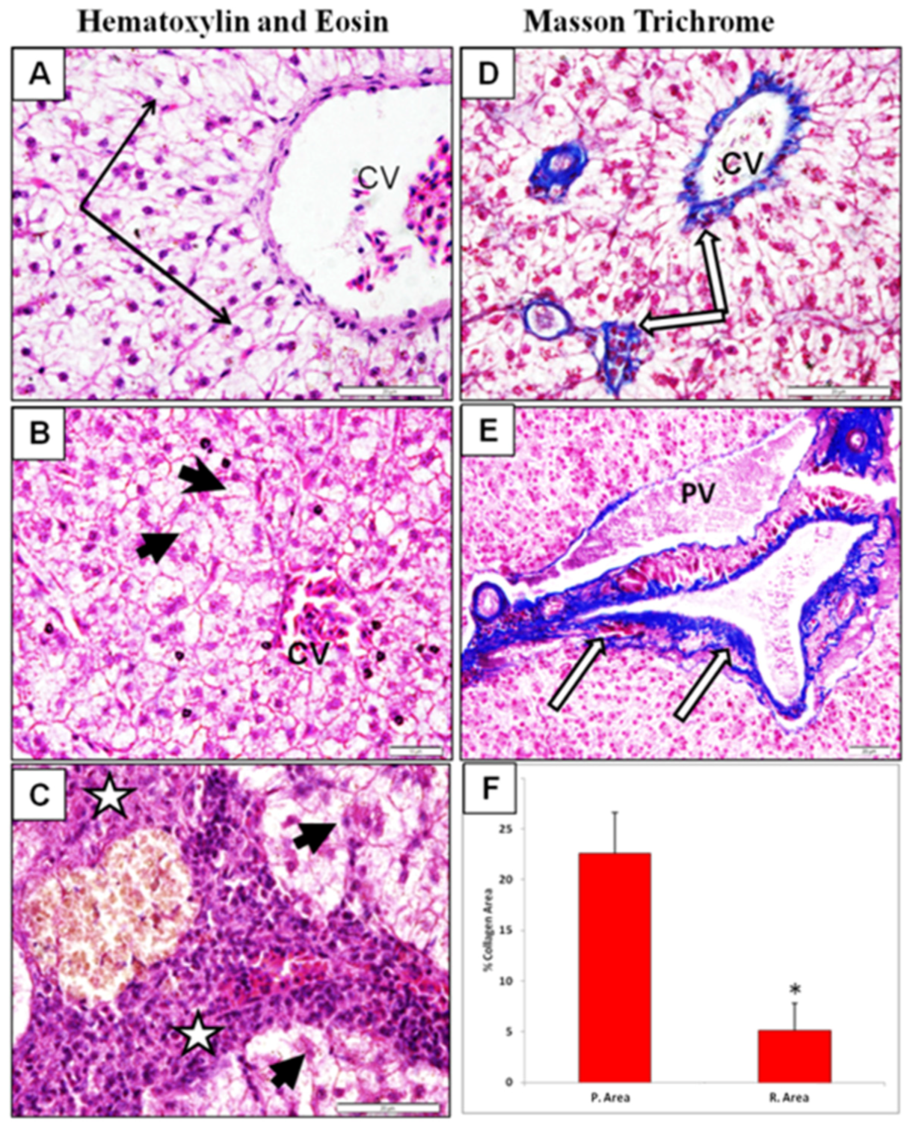Ijerph 13 00342 g004