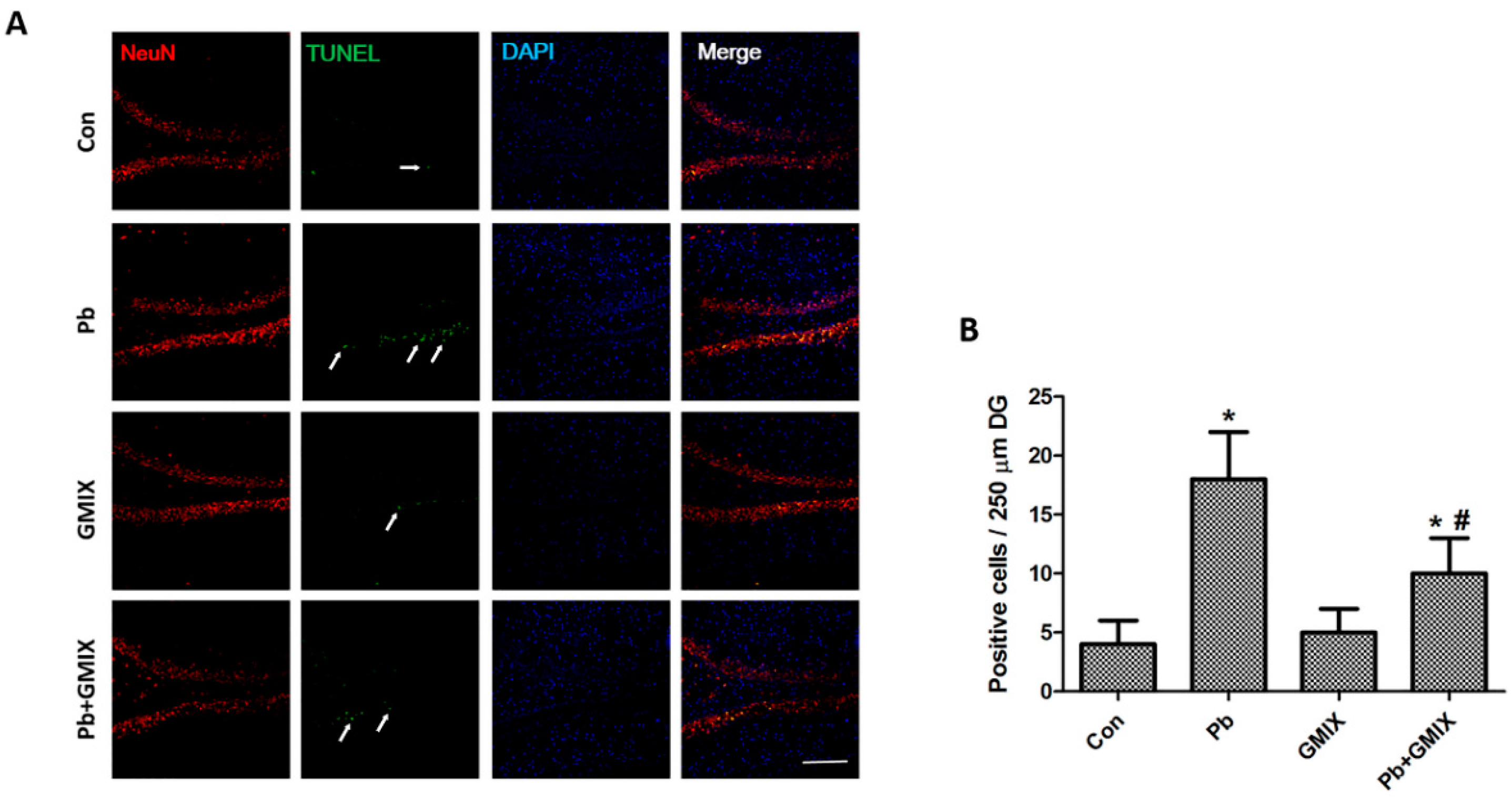 Ijerph 13 00365 g002 1024