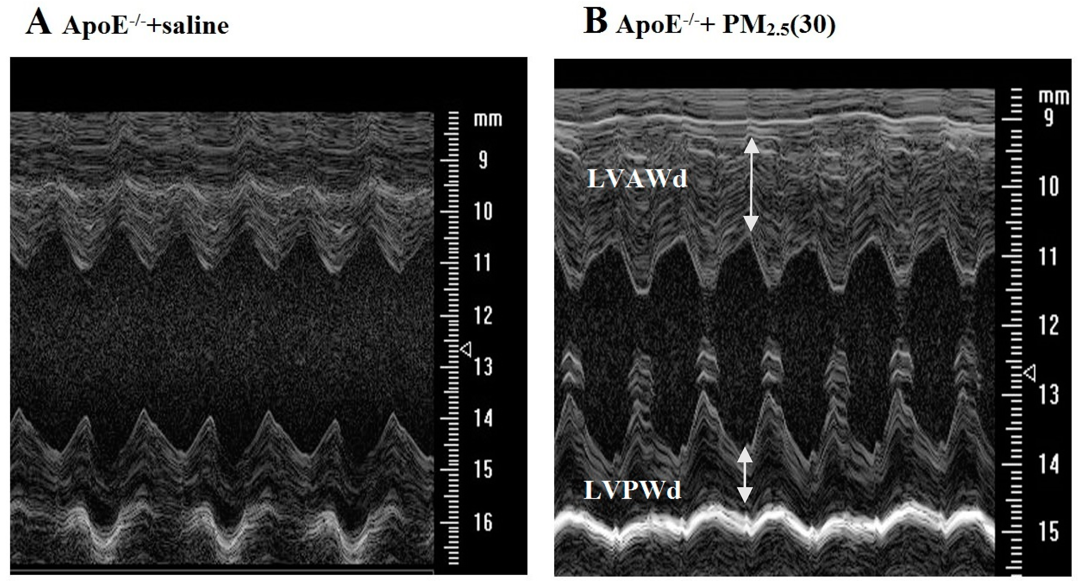 Ijerph 13 00484 g003