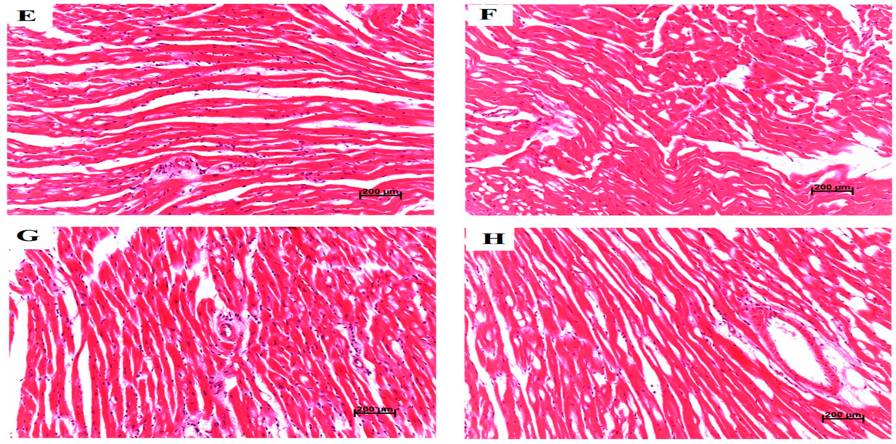 Ijerph 13 00484 g007b