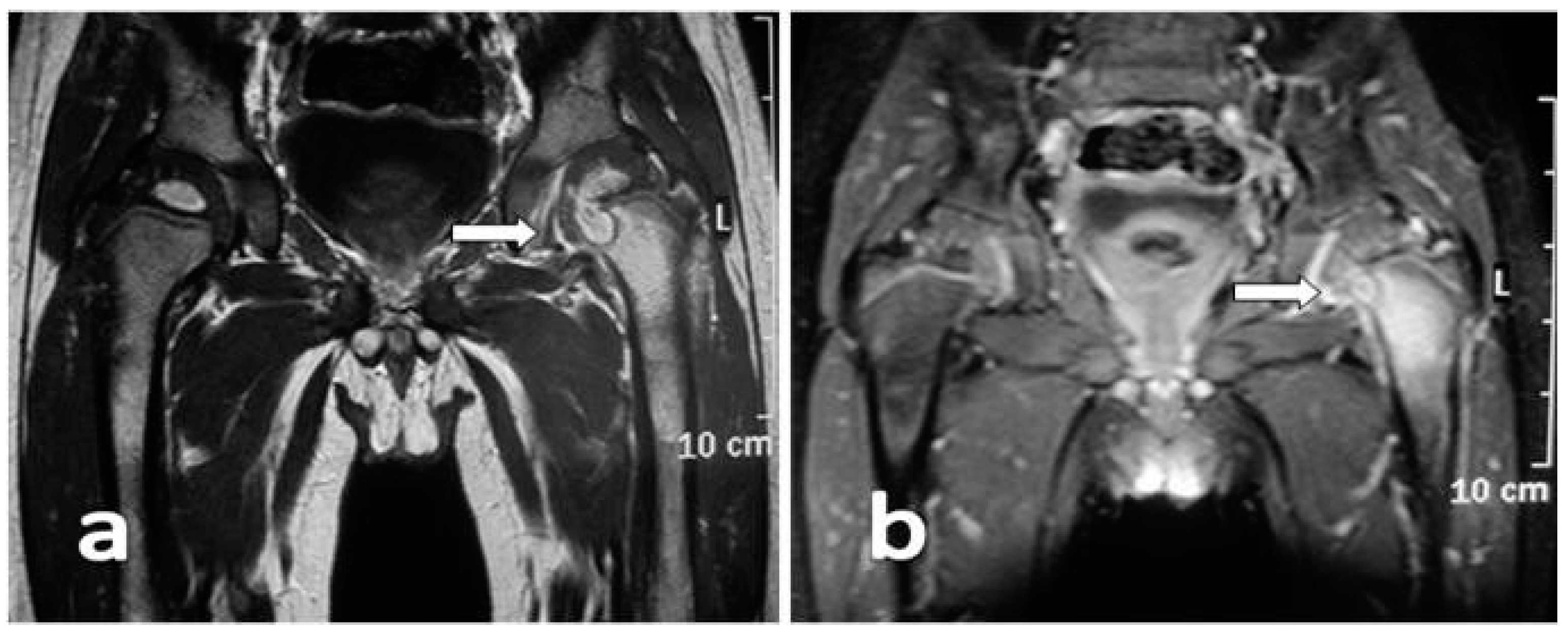 Ijerph 13 00539 g002