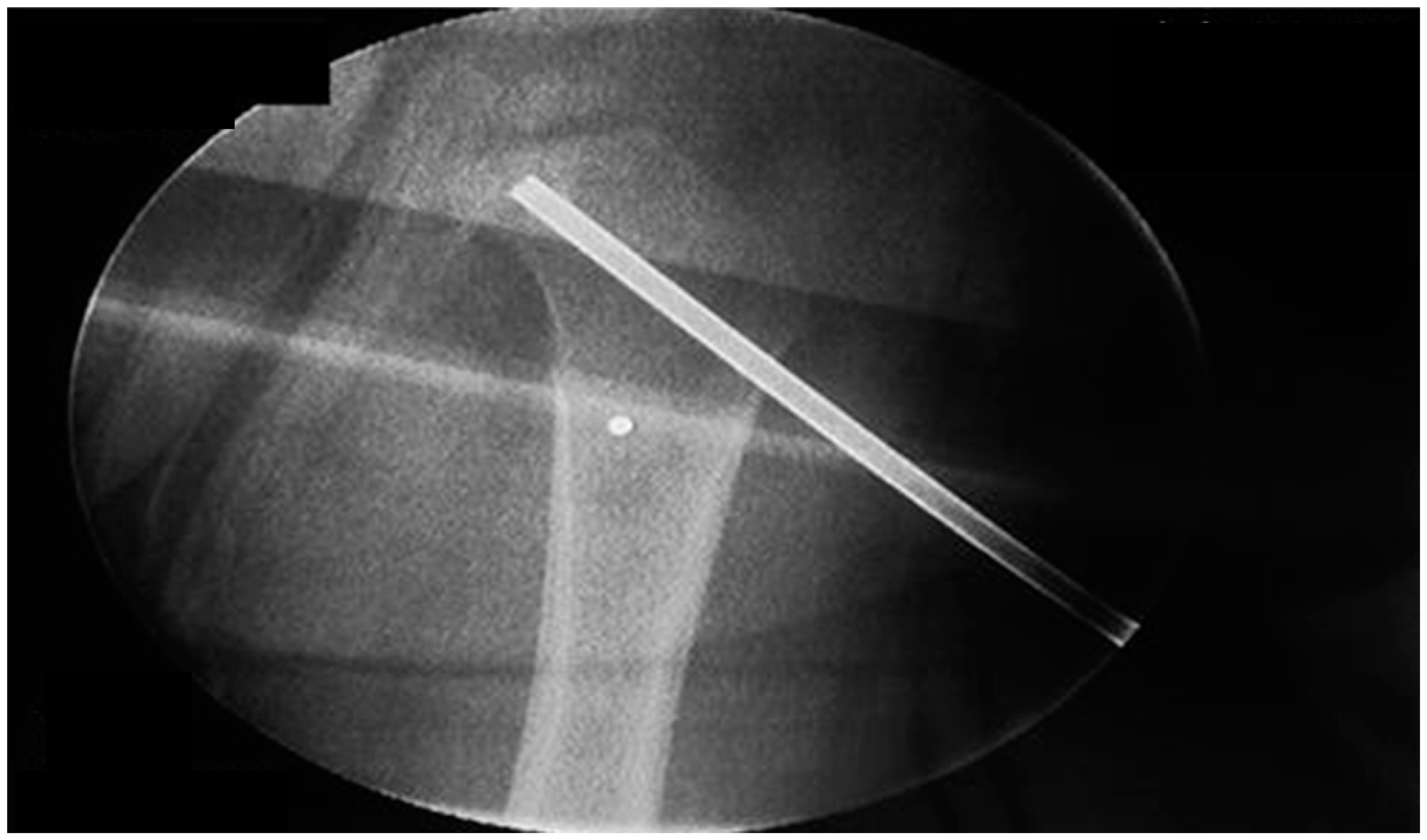 Ijerph 13 00539 g003