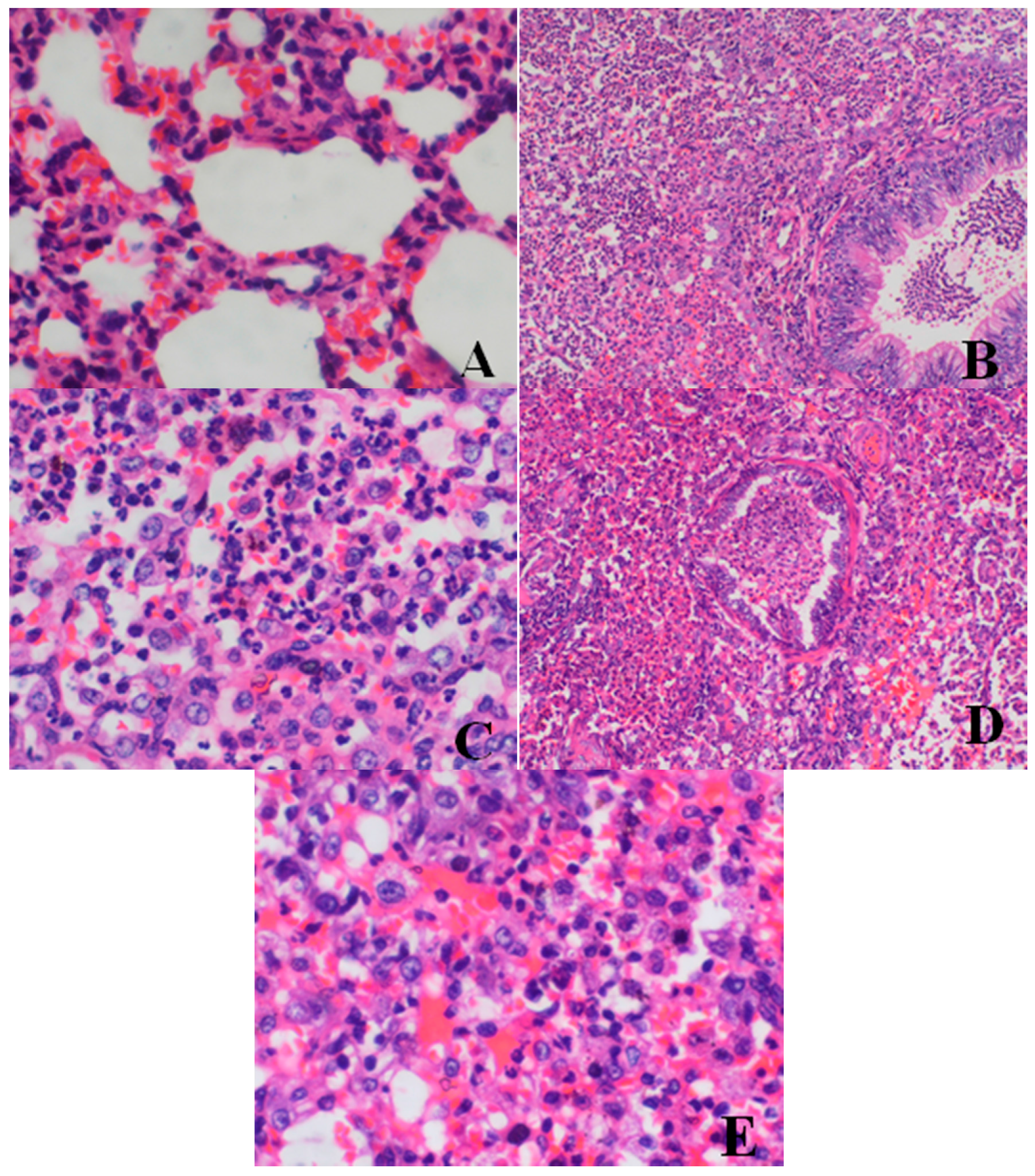 Ijerph 13 01190 g003 550