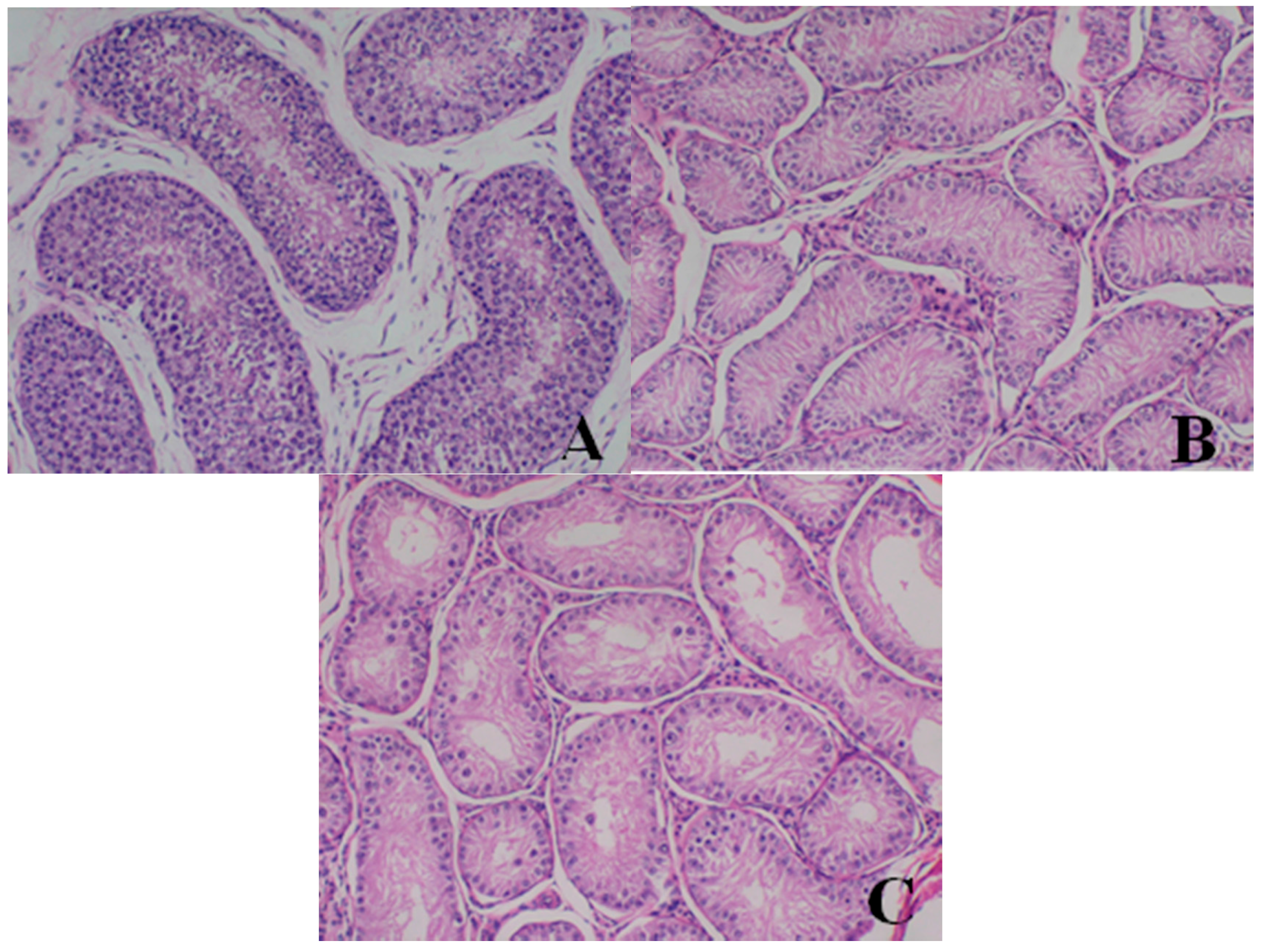 Ijerph 13 01190 g005 550