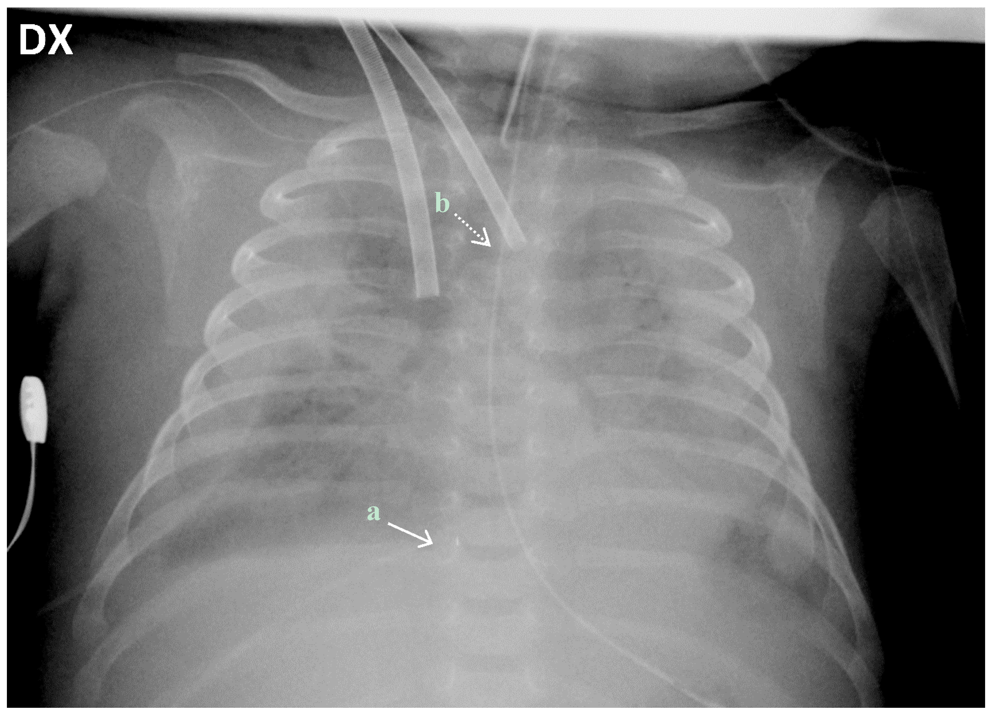 Ijerph 14 00360 g002