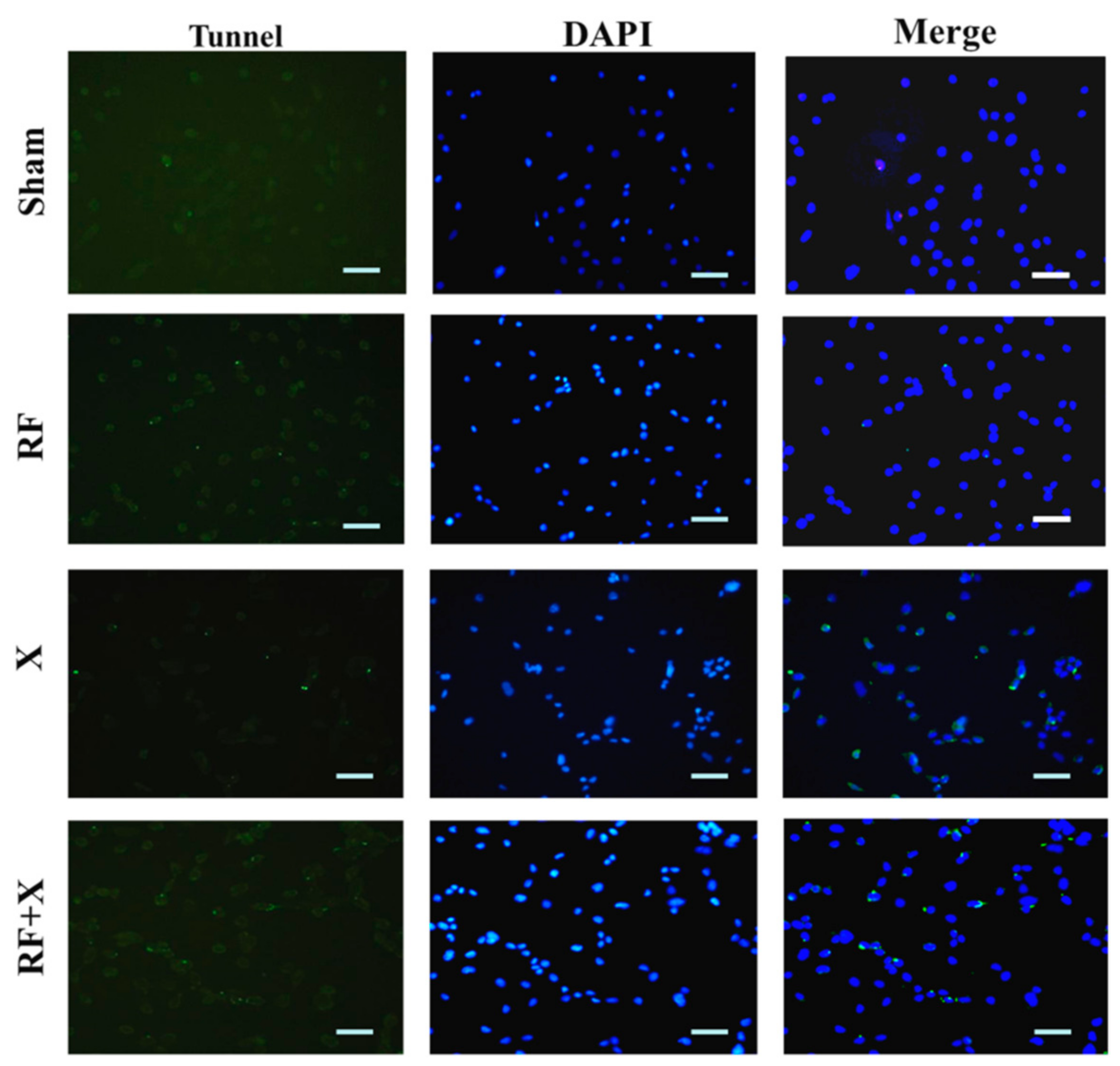 Ijerph 14 00616 g004
