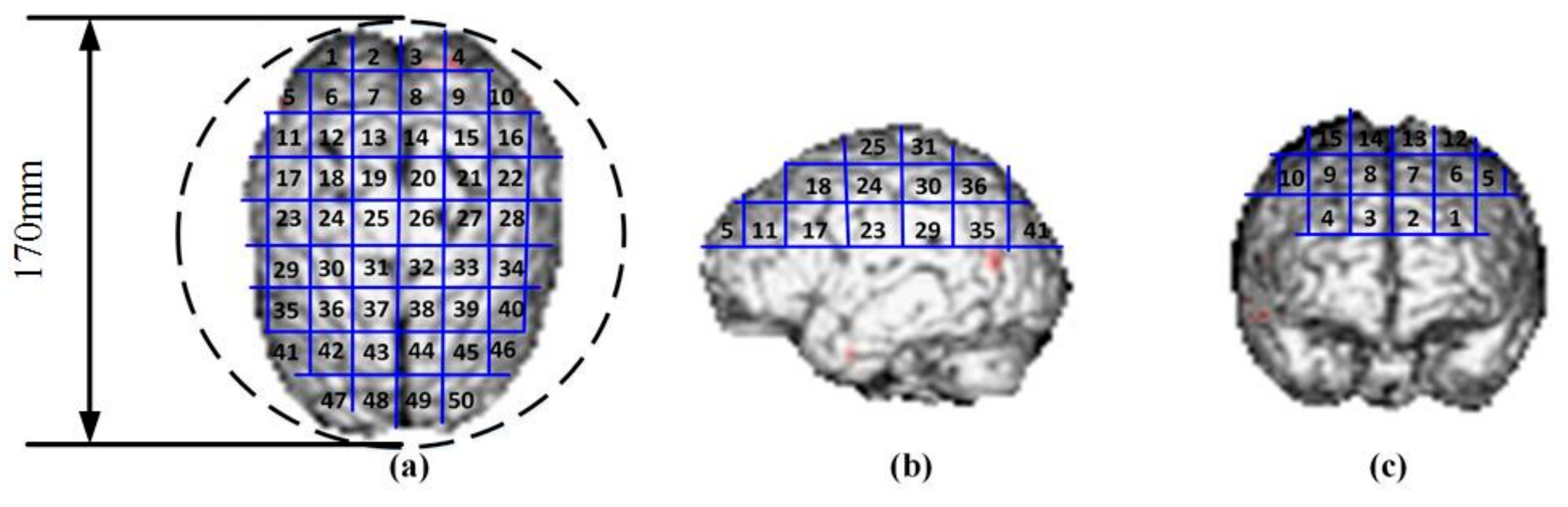 Ijerph 14 01388 g001 Ijerph 14 01388 g001