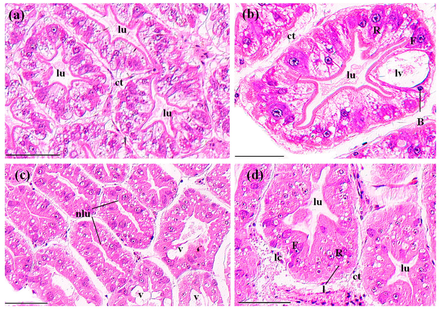 Ijerph 14 01466 g003 550
