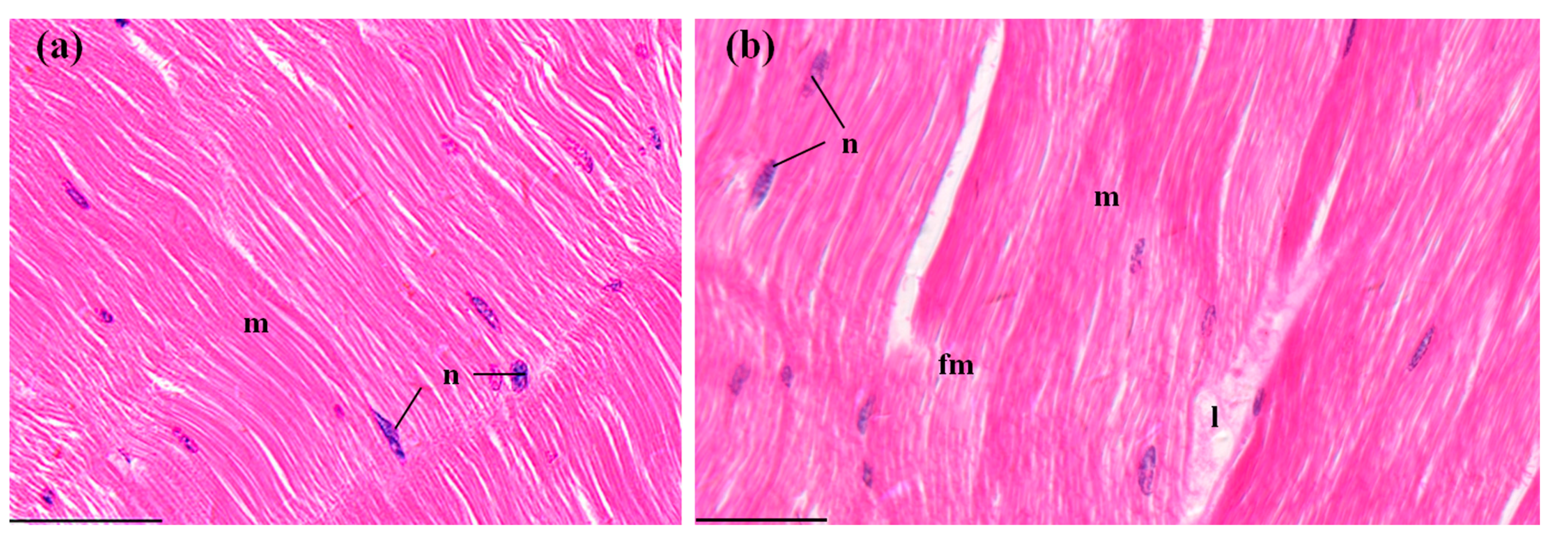Ijerph 14 01466 g007 550