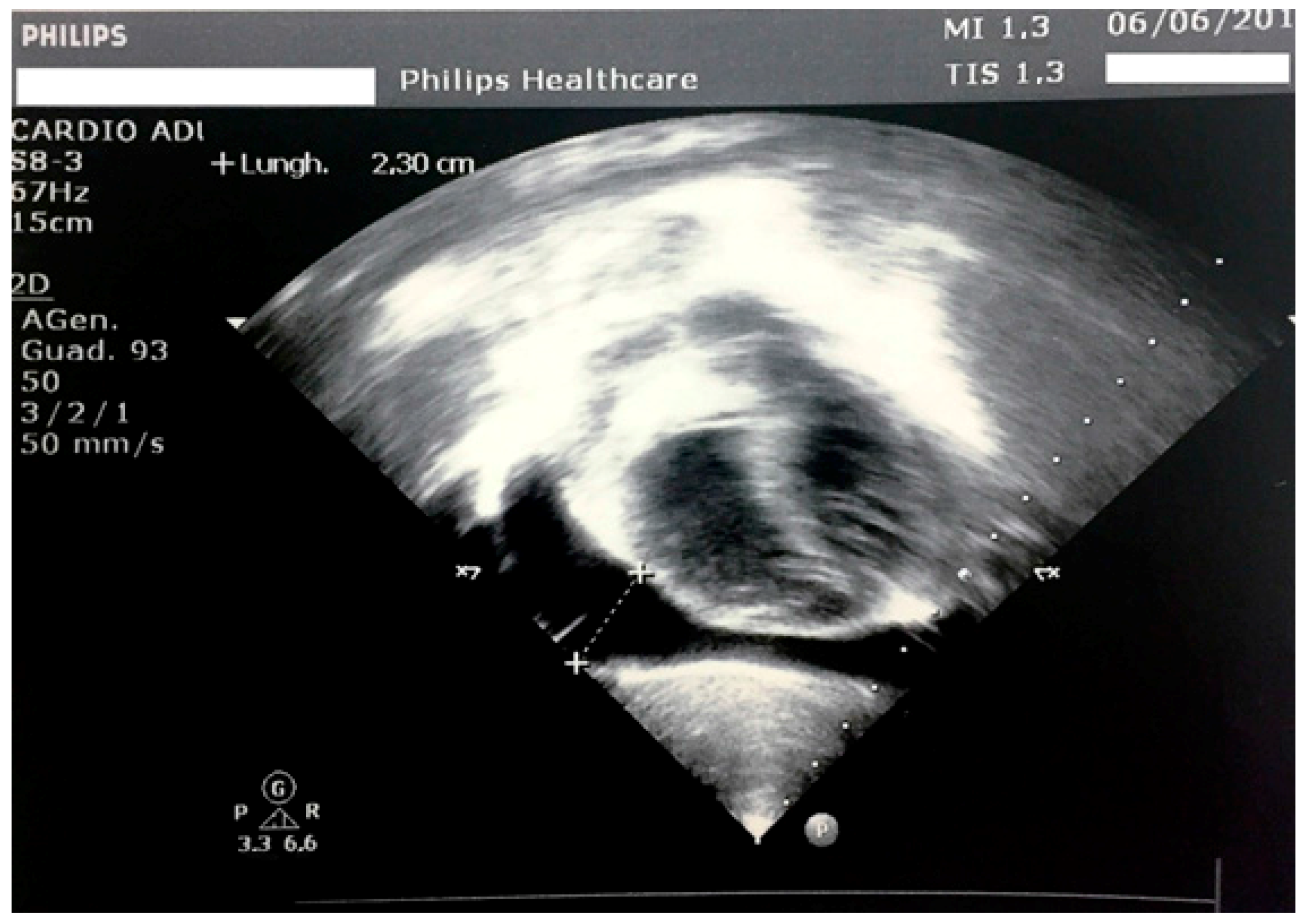 Ijerph 14 01576 g001 Ijerph 14 01576 g001