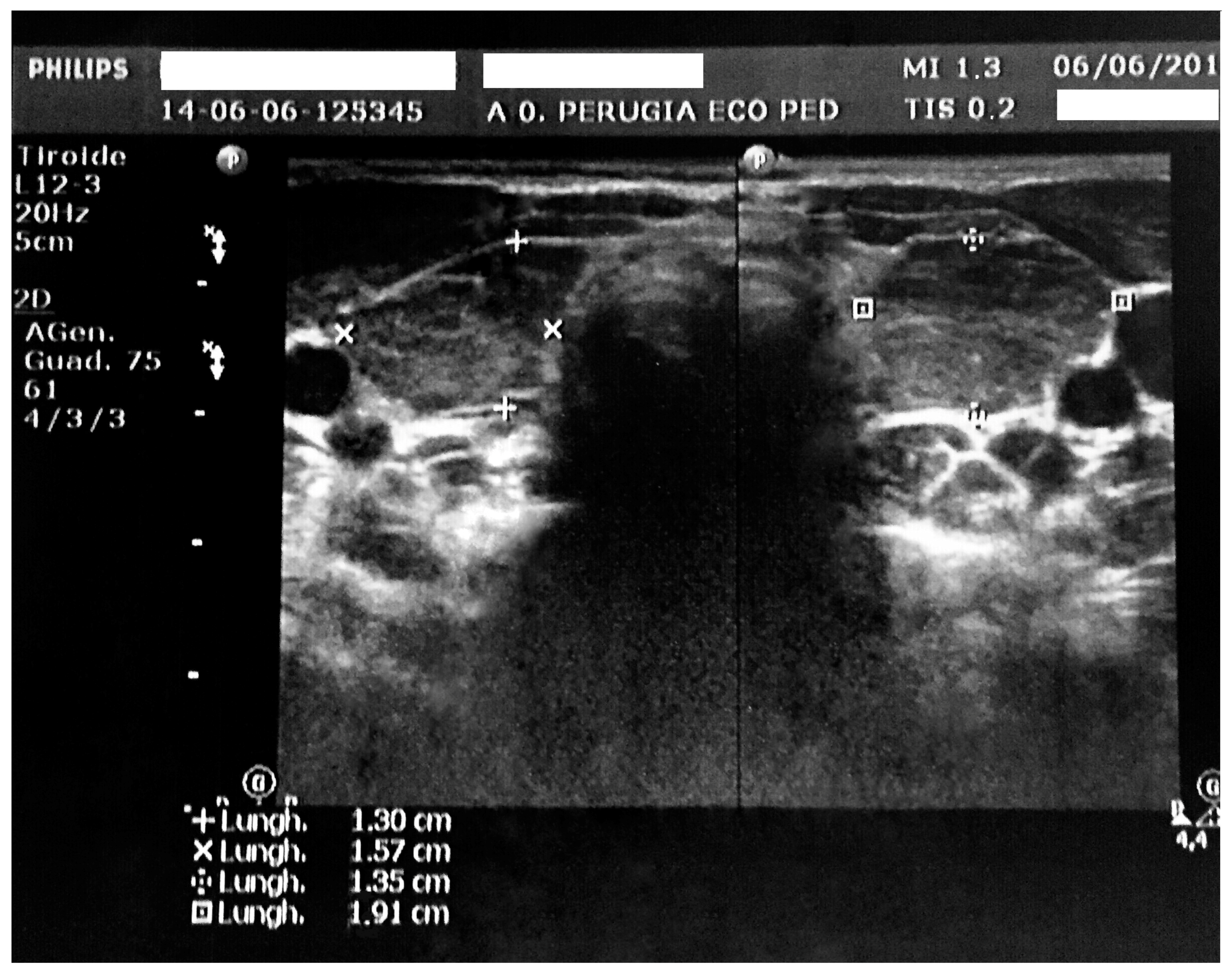 Ijerph 14 01576 g002 Ijerph 14 01576 g002