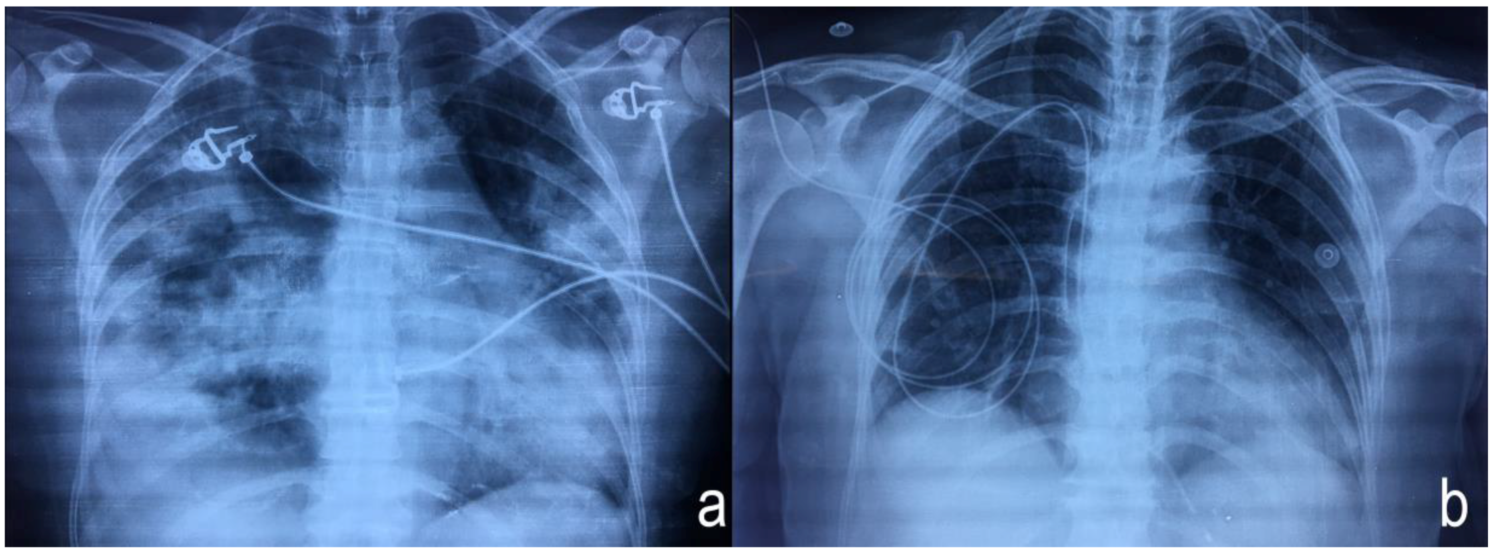 Ijerph 15 00657 g002 Ijerph 15 00657 g002