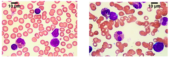 Ijerph 15 01169 g001 Ijerph 15 01169 g001