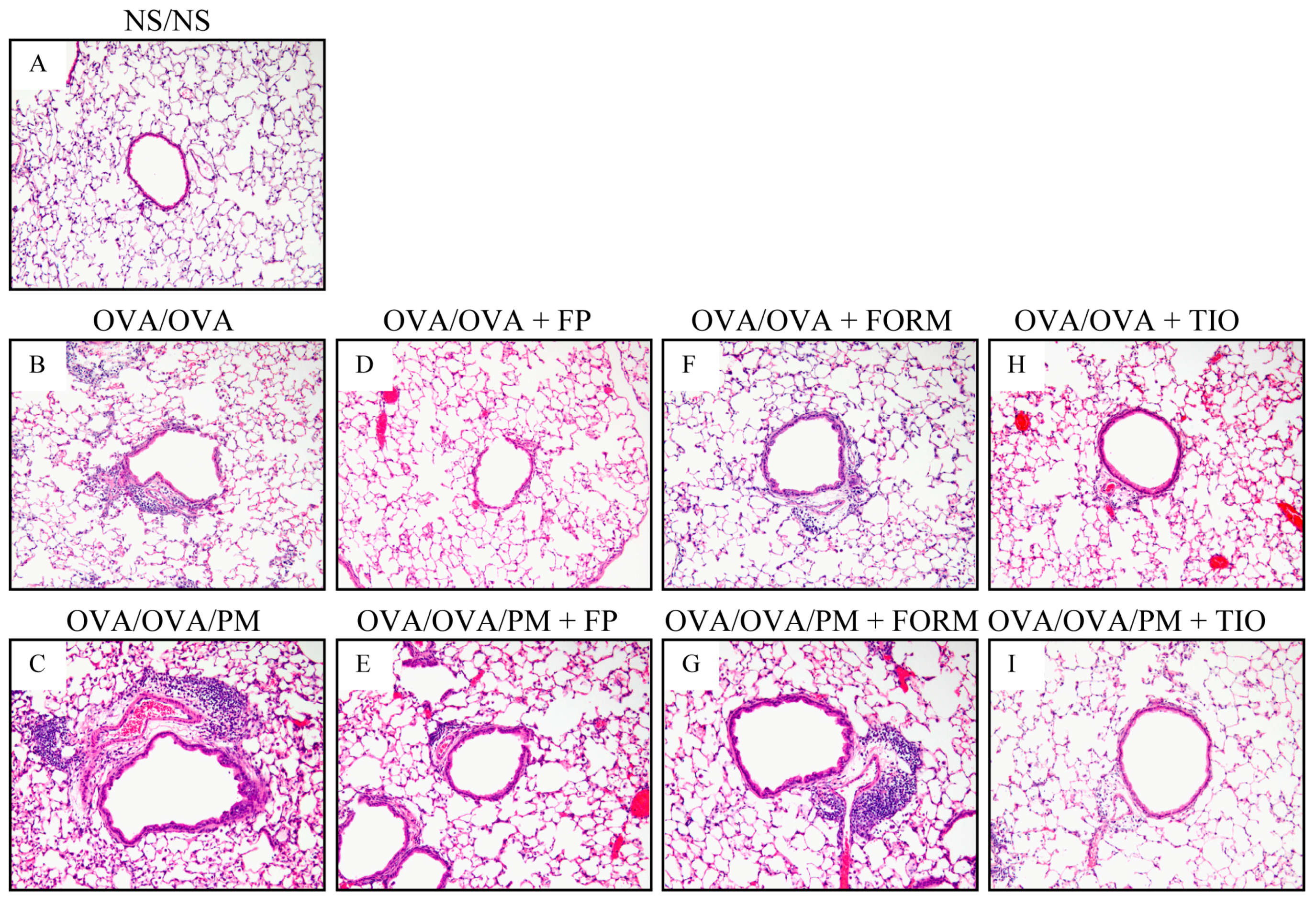 Ijerph 15 01189 g004