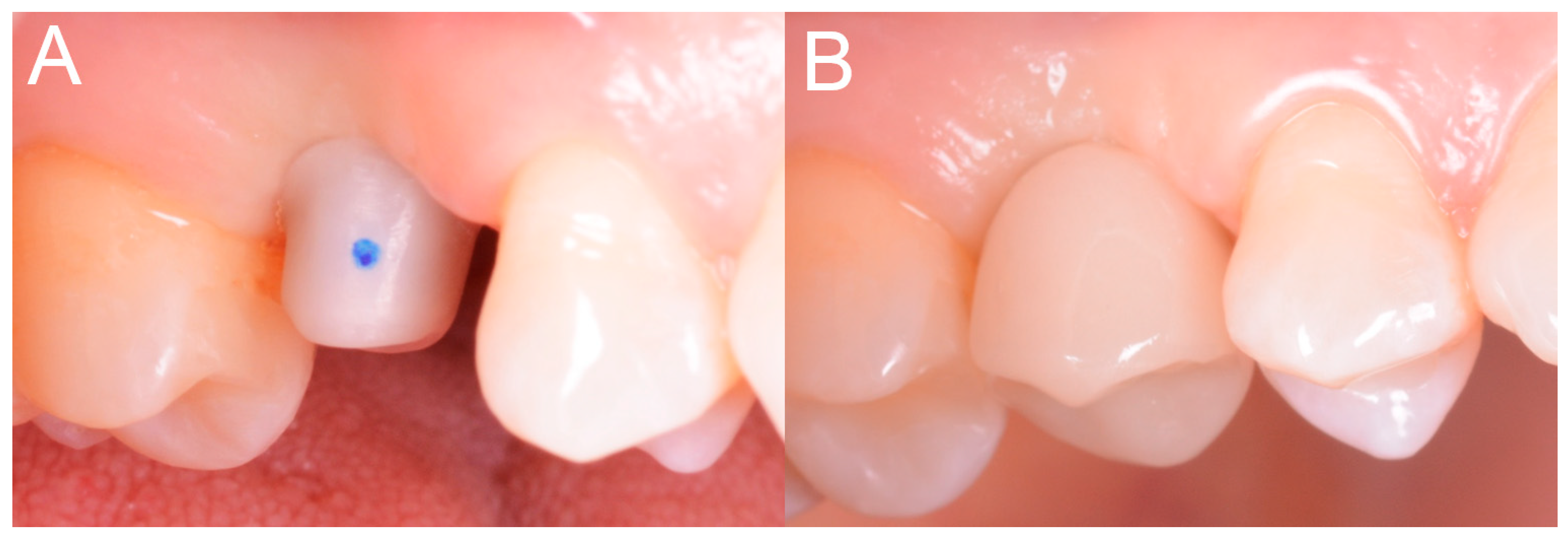 Ijerph 15 02361 g013