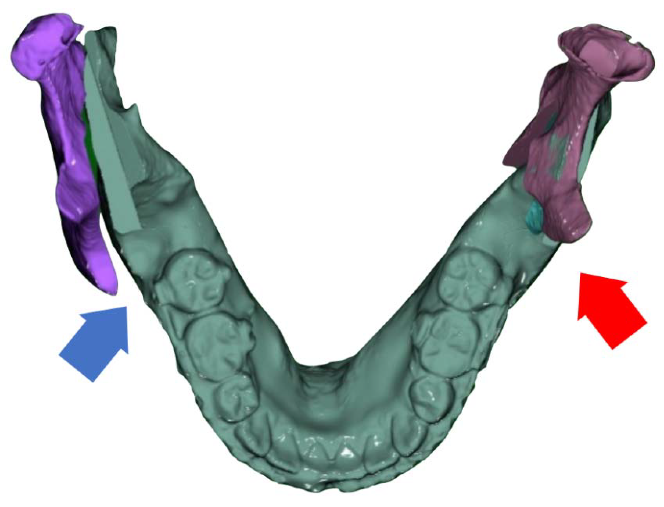 Ijerph 15 02380 g003 Ijerph 15 02380 g003