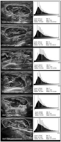 IJERPH | Free Full-Text | Quantitative Ultrasound Imaging Pixel Analysis of the Intrinsic ...