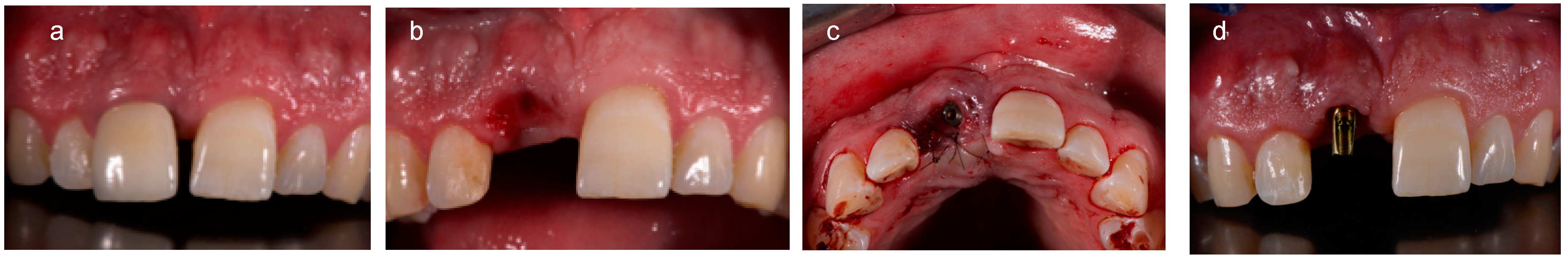 Ijerph 15 02623 g002 550