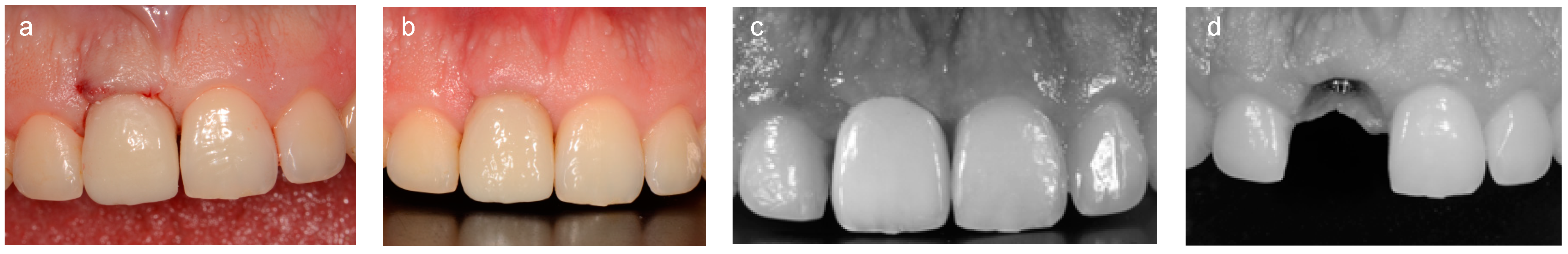 Ijerph 15 02623 g003 550