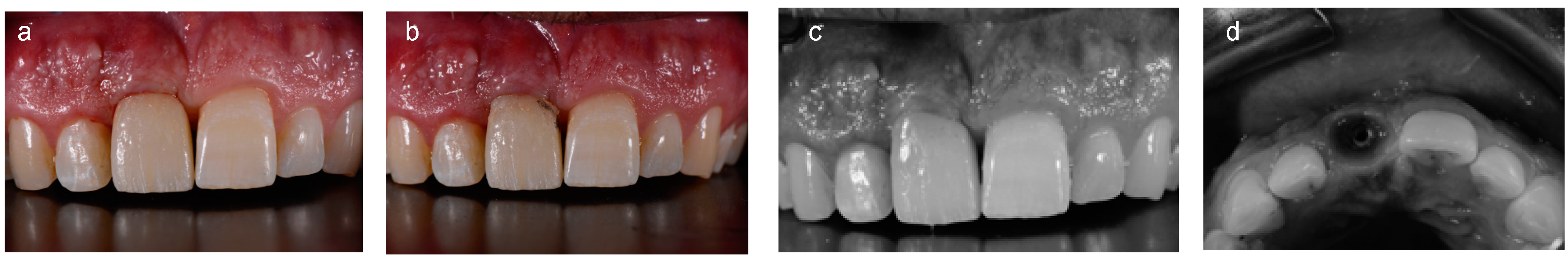 Ijerph 15 02623 g004 550