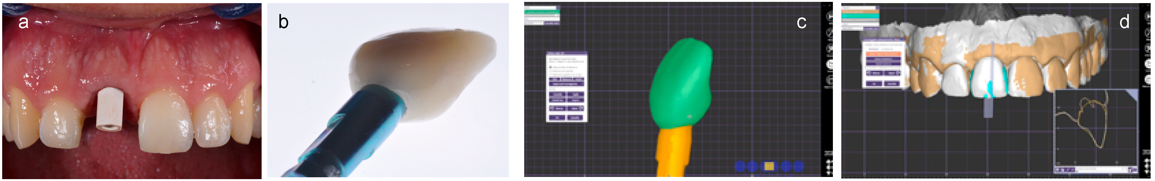 Ijerph 15 02623 g005 550