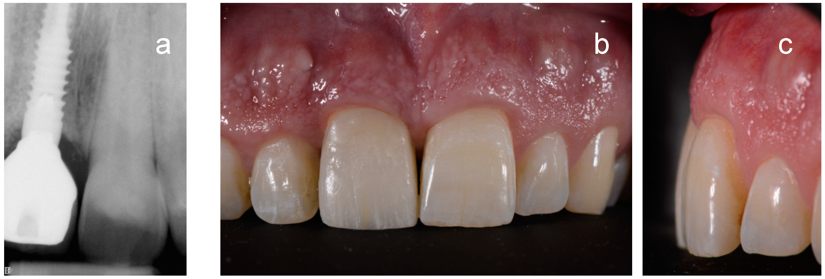 Ijerph 15 02623 g008 550