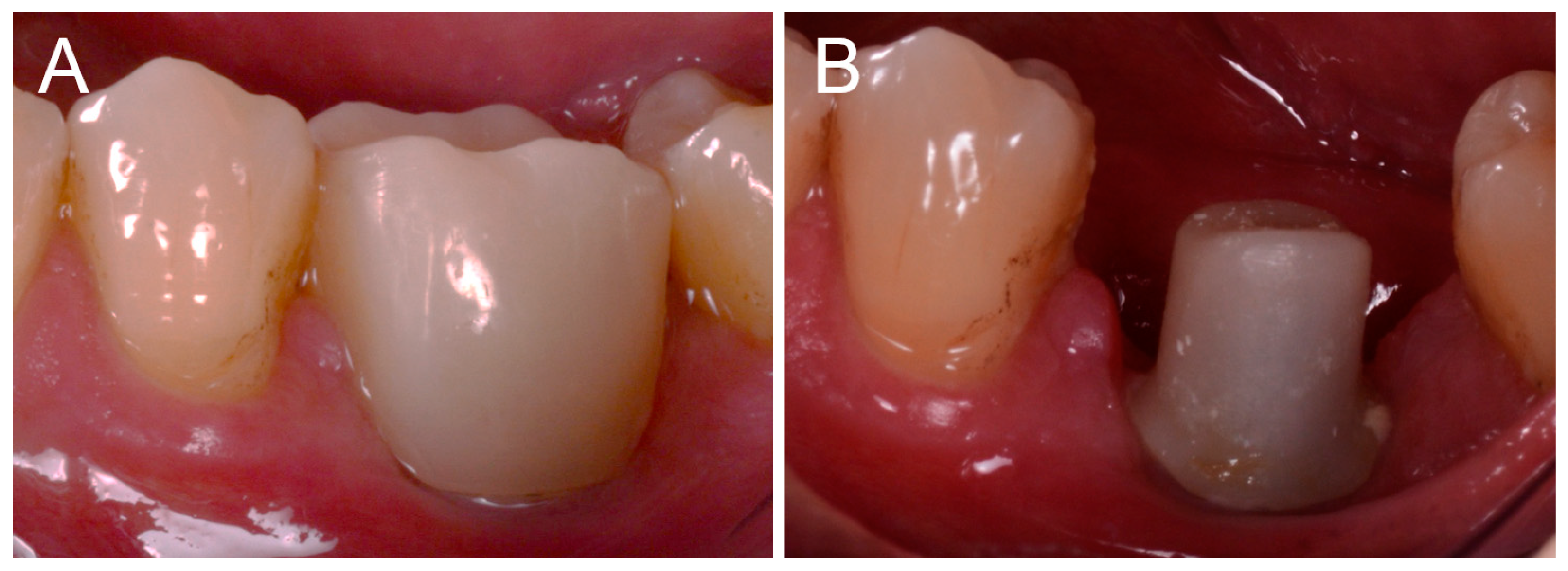 Ijerph 16 00317 g006