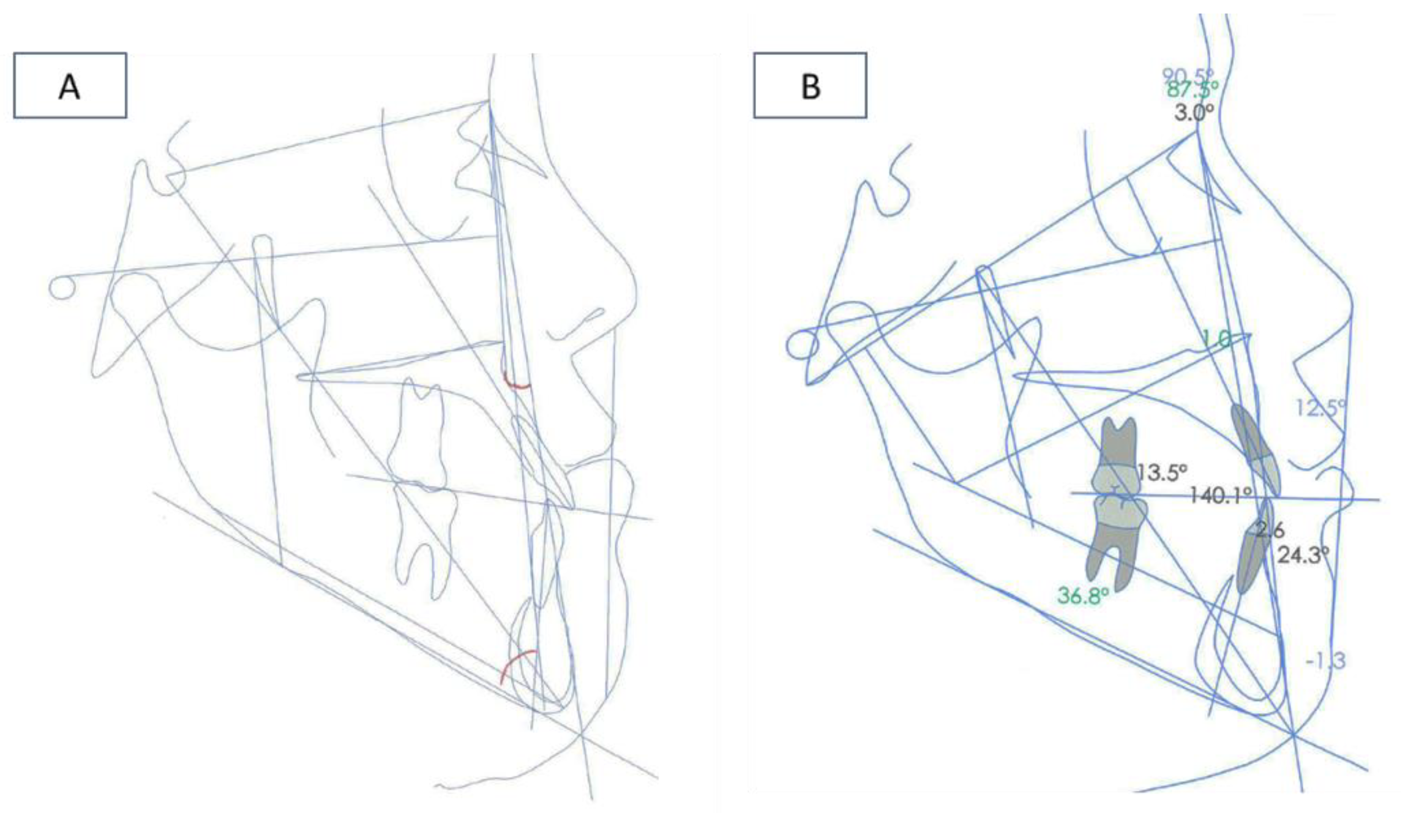 Ijerph 16 00928 g004 550