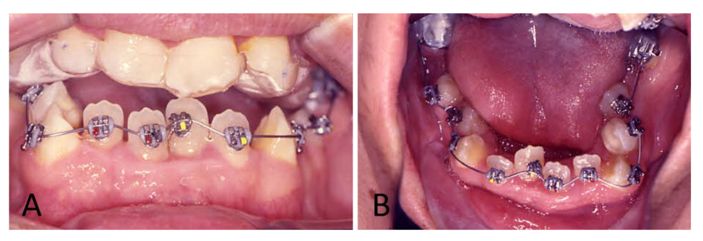 pathological condition lle pathological condition lle