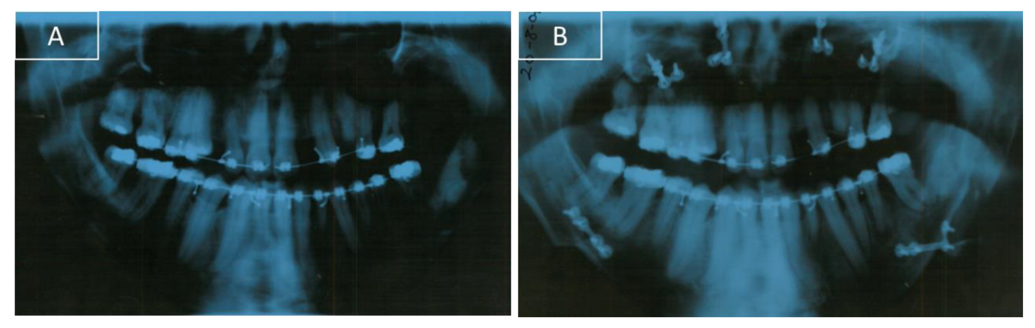 Ijerph 16 00928 g006 550