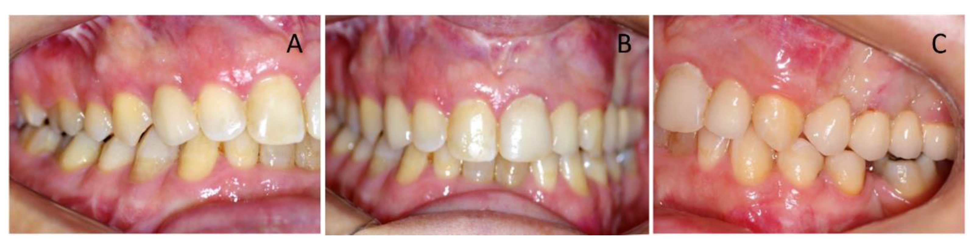 Ijerph 16 00928 g009 550