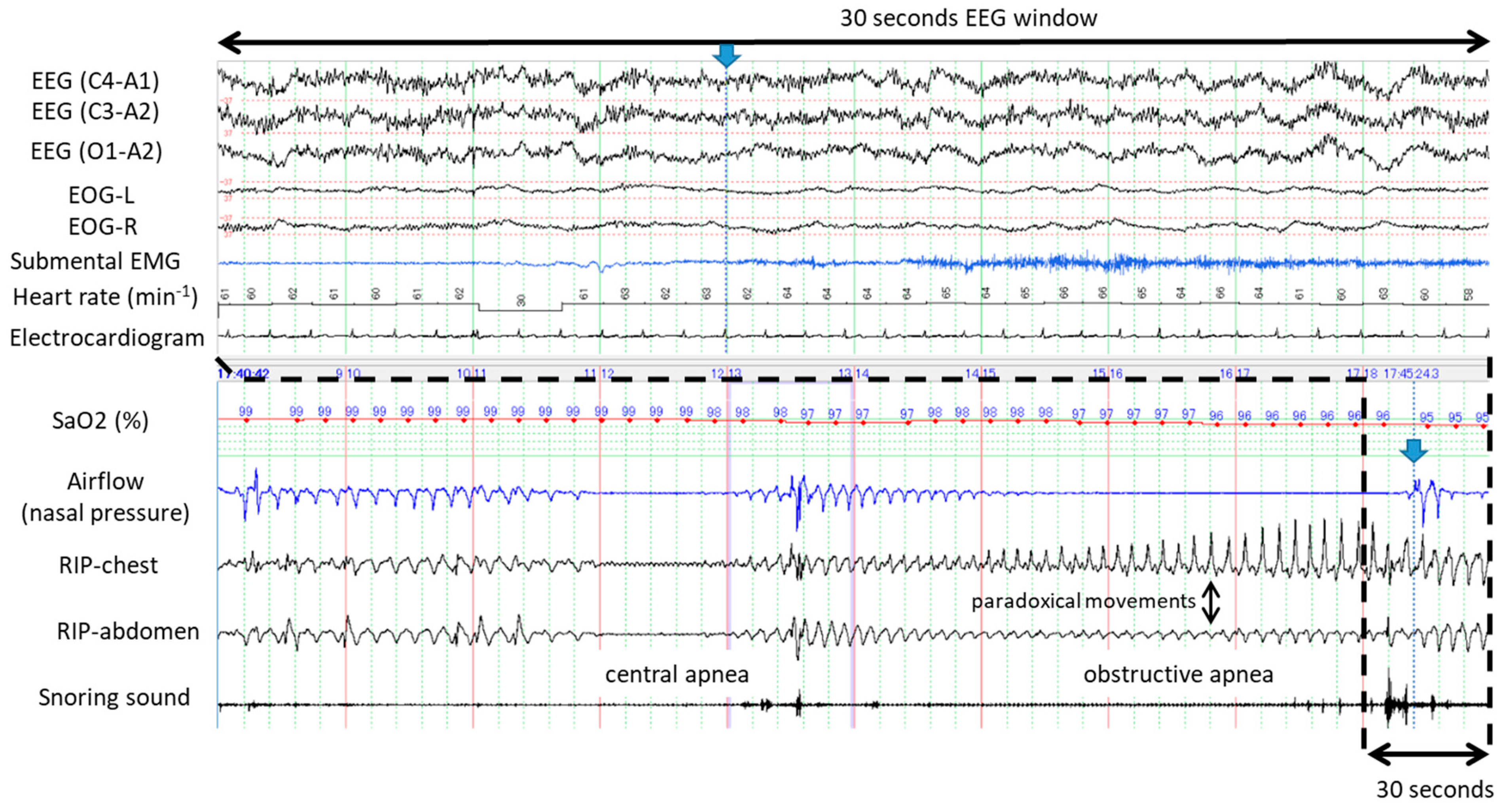 Ijerph 16 03482 g002 Ijerph 16 03482 g002