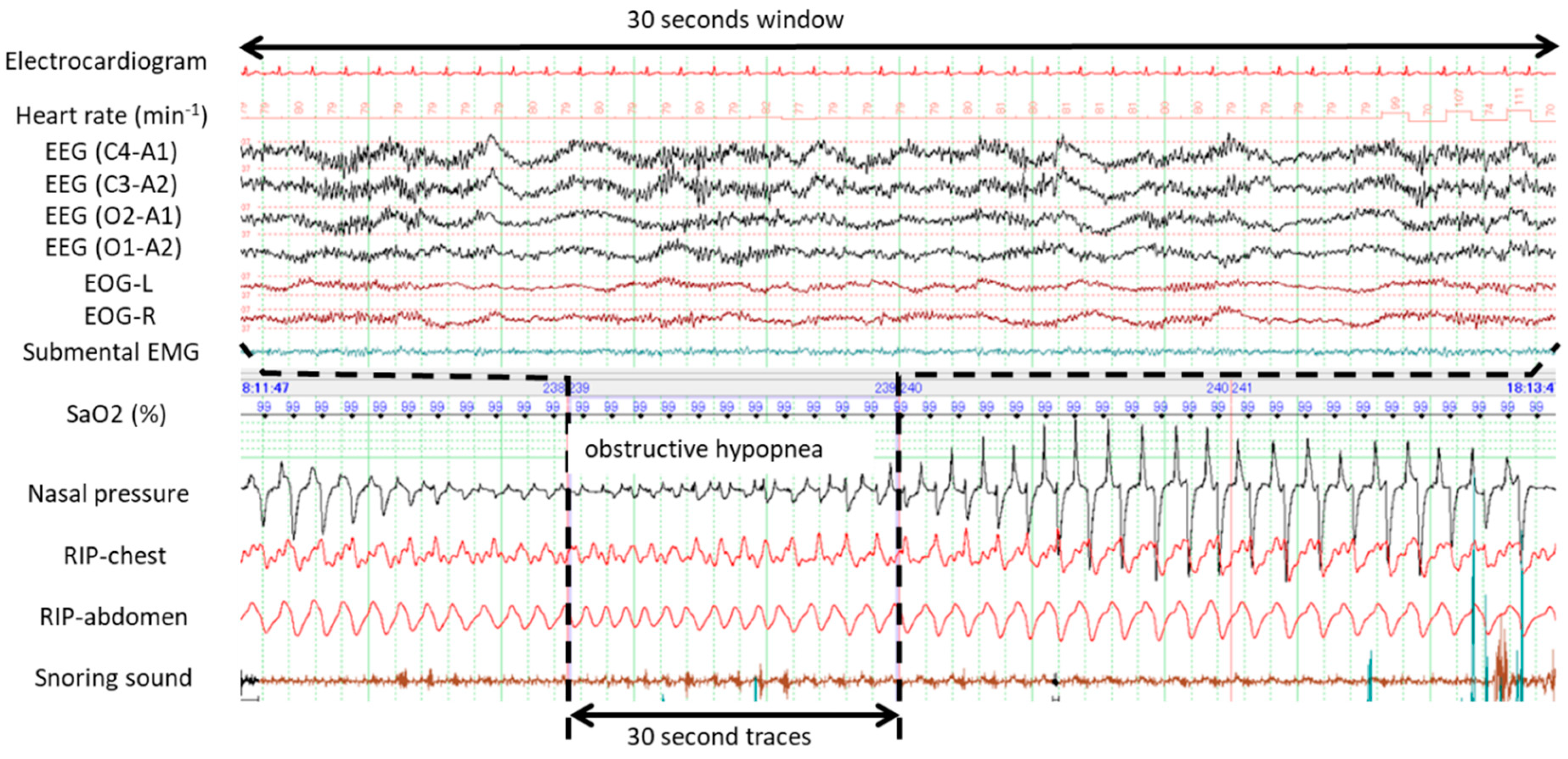 Ijerph 16 03482 g003 Ijerph 16 03482 g003