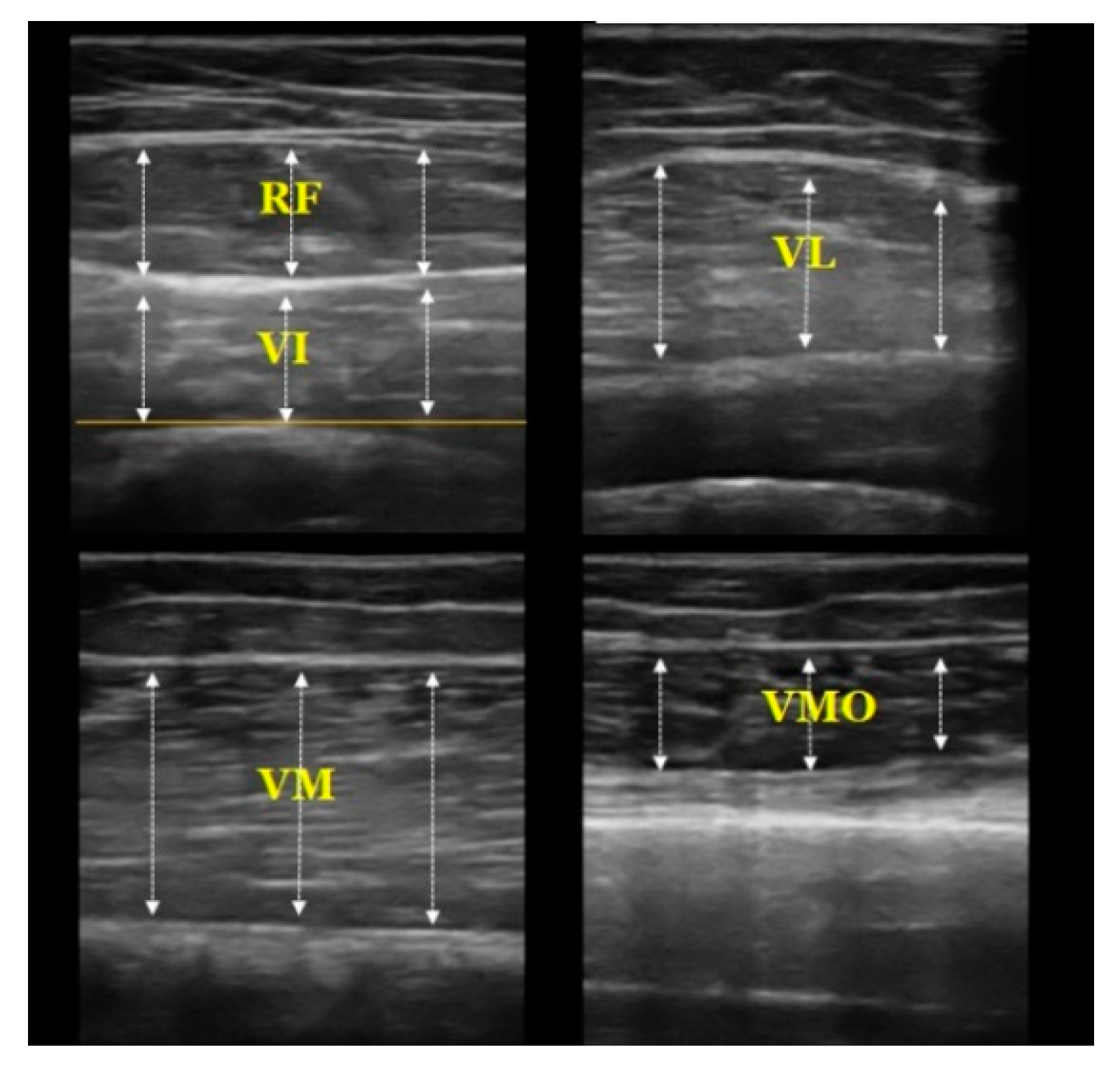 Ijerph 16 04895 g003 Ijerph 16 04895 g003