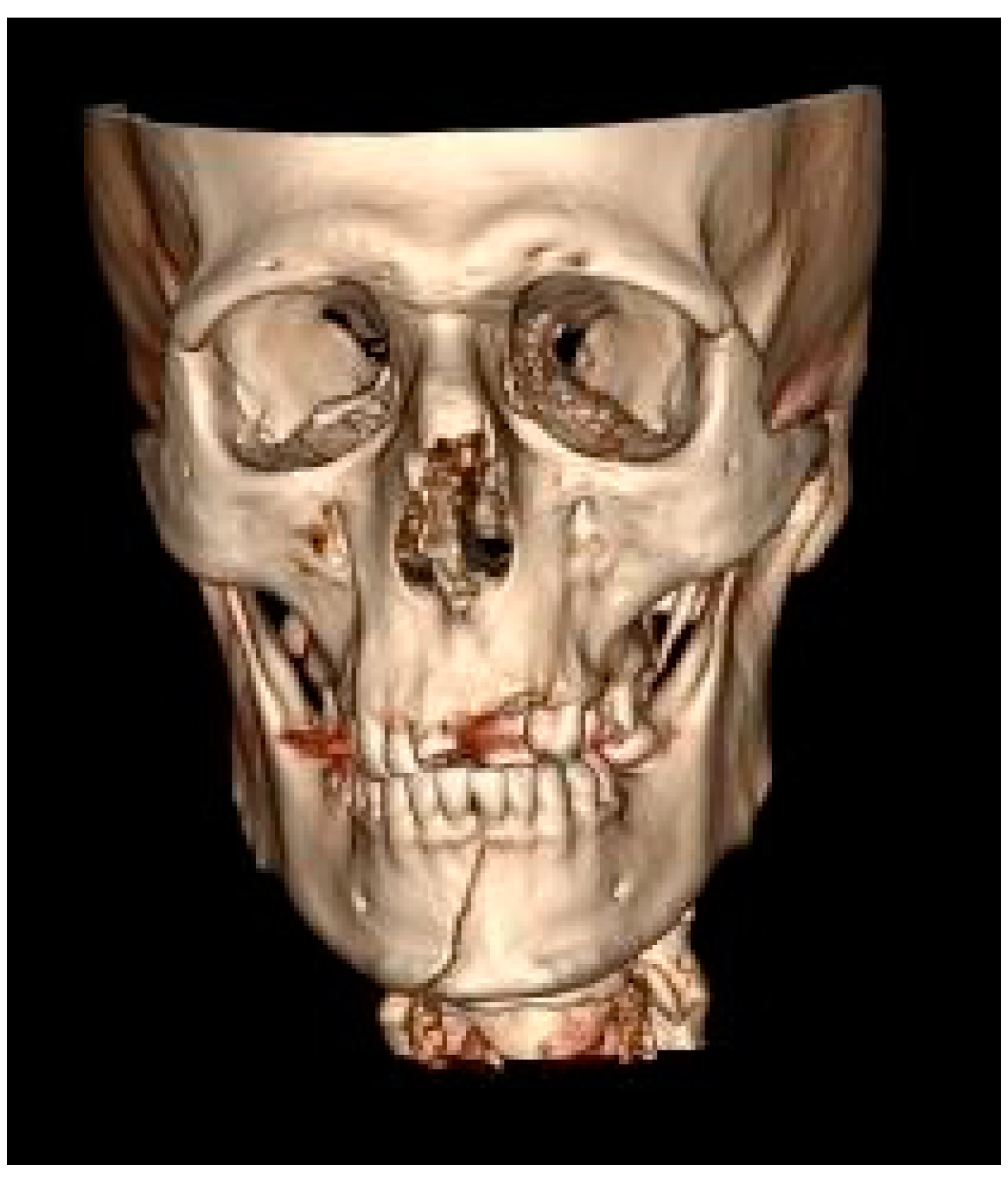 Ijerph 17 00004 g001