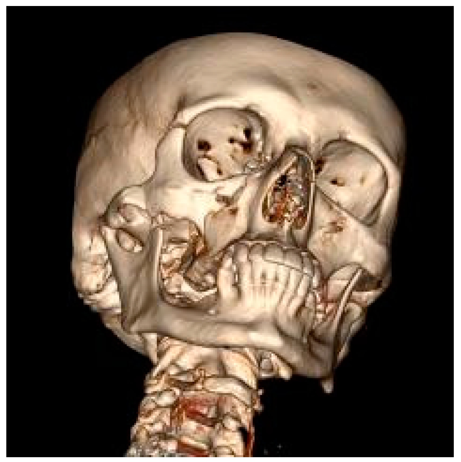 Ijerph 17 00004 g002