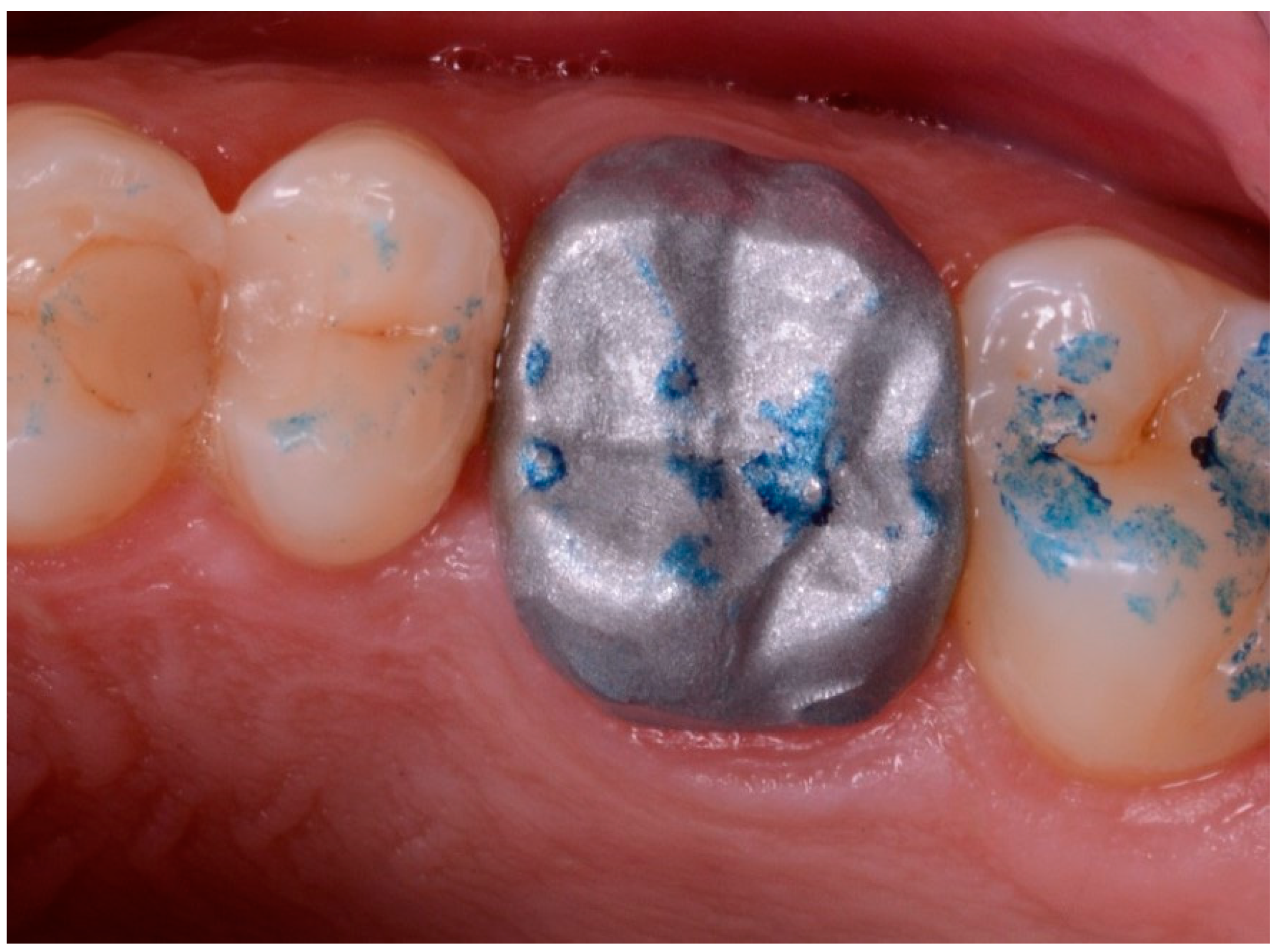 Ijerph 17 00392 g010 Ijerph 17 00392 g010