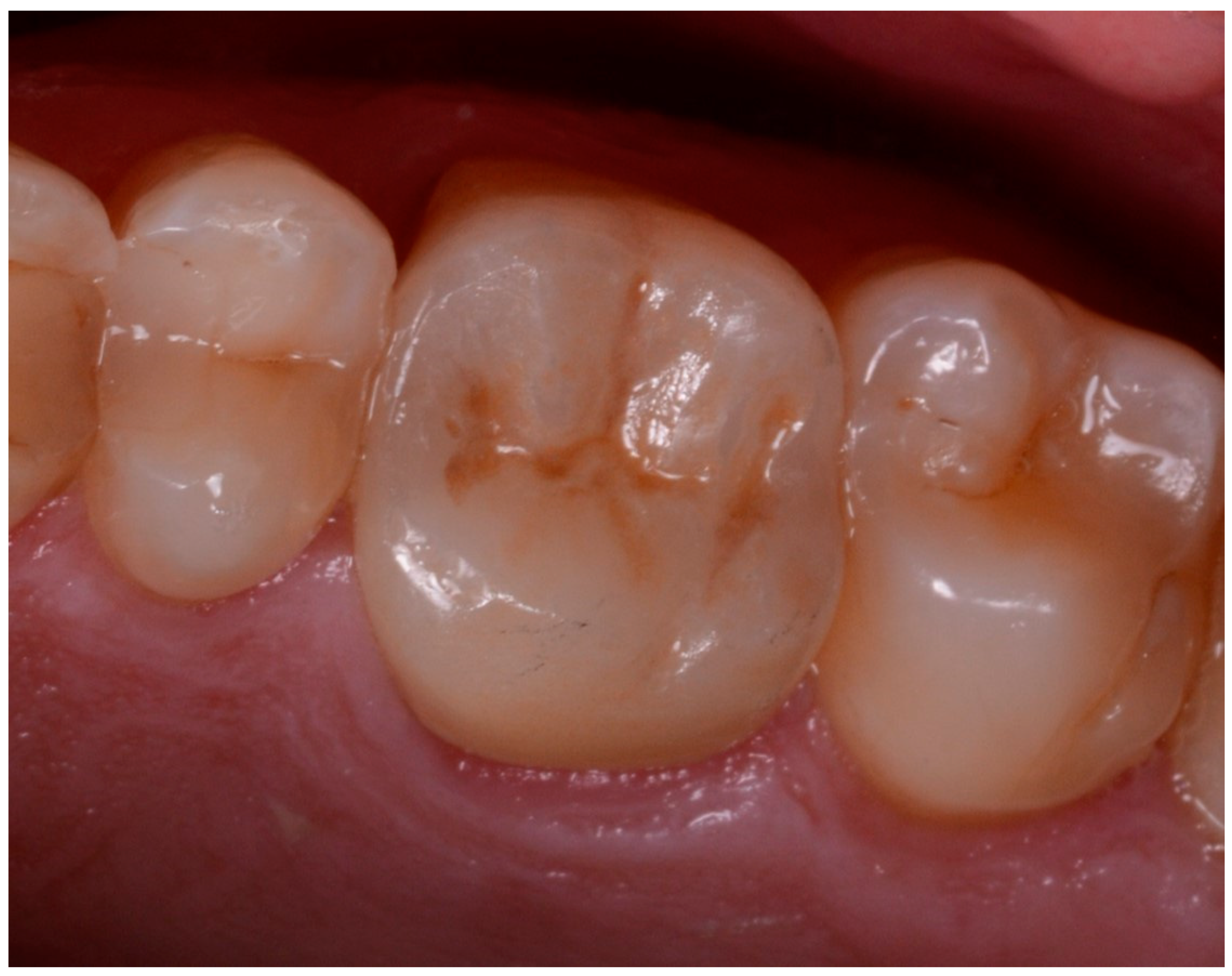 Ijerph 17 00392 g011 Ijerph 17 00392 g011