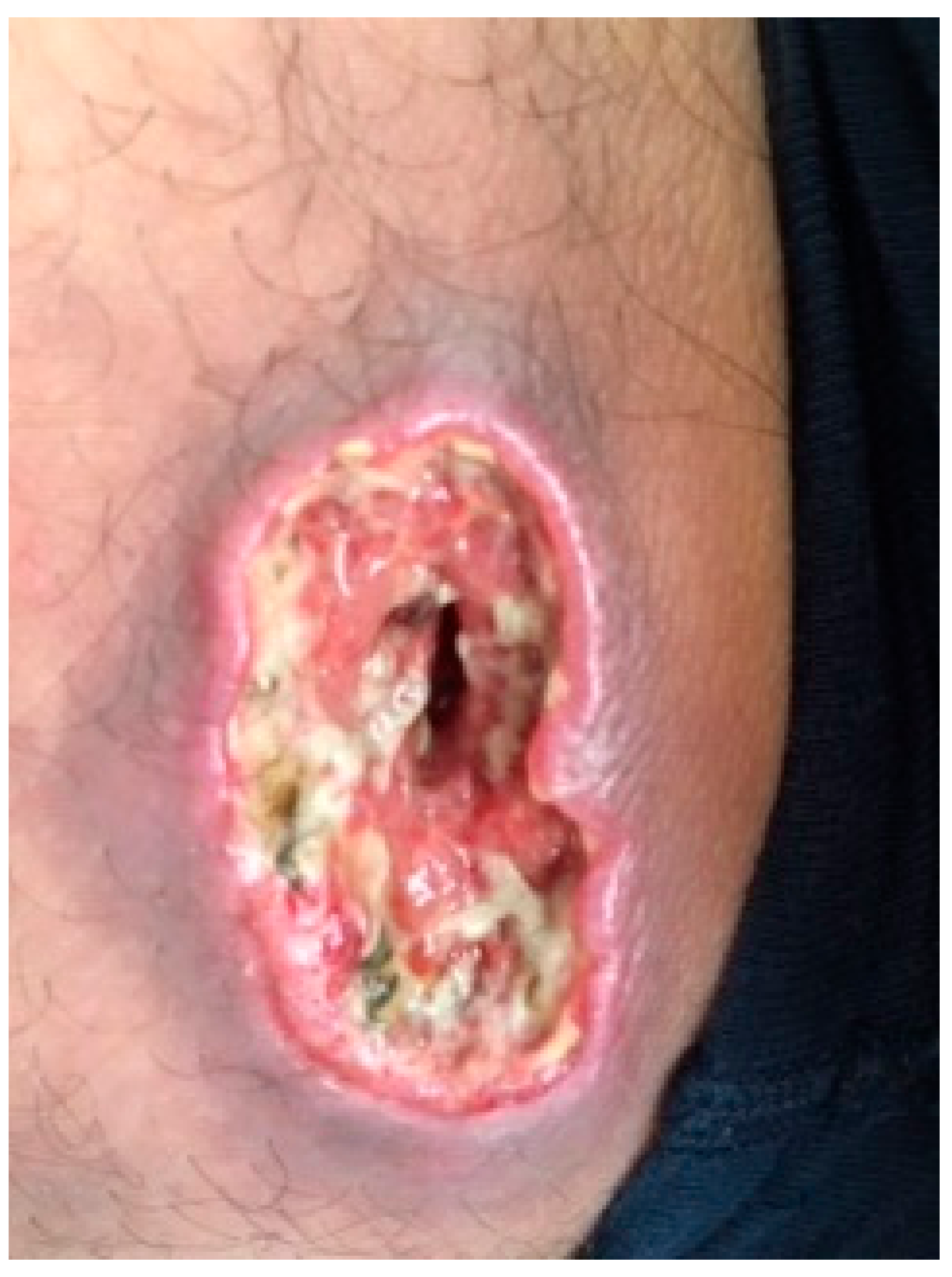 Ijerph 17 00839 g003