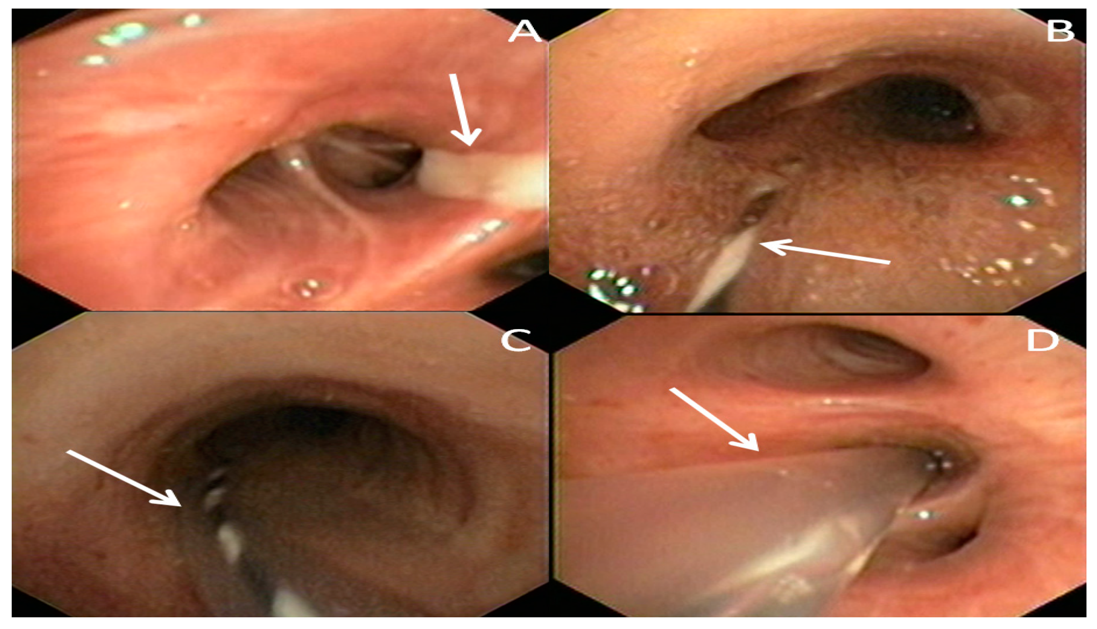 Ijerph 17 00997 g001