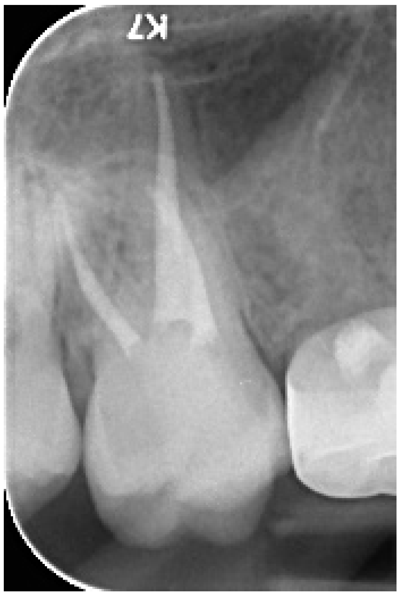 Ijerph 17 01364 g002