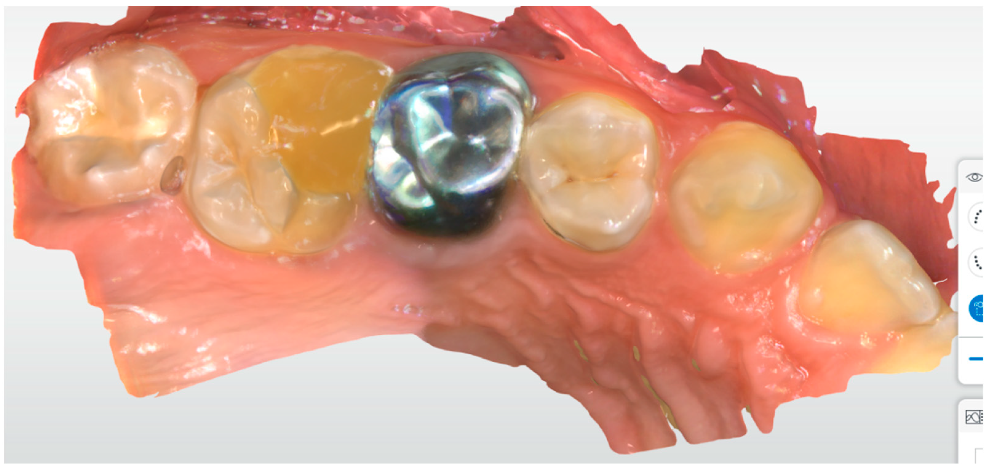 Ijerph 17 01364 g003