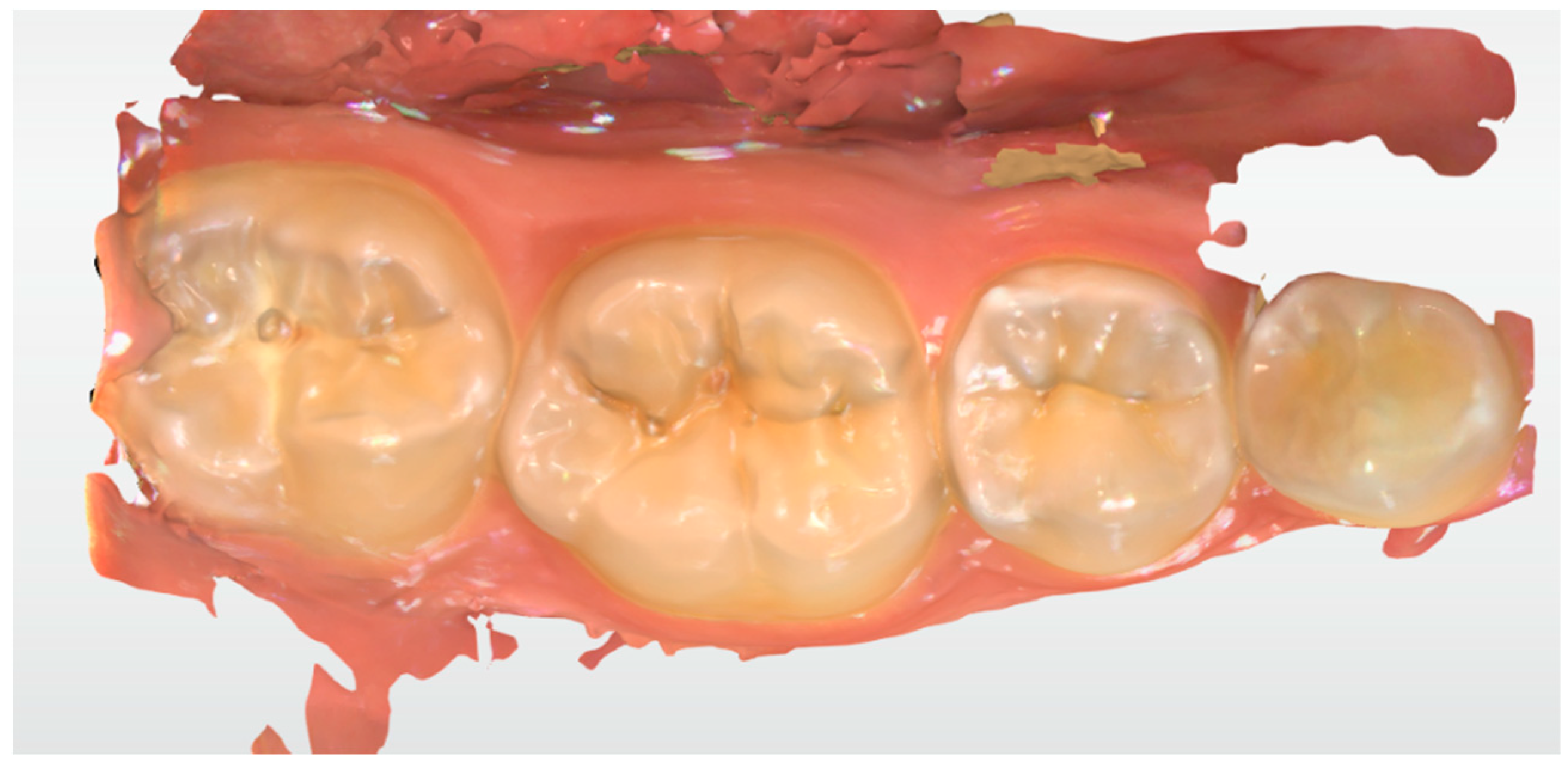 Ijerph 17 01364 g005