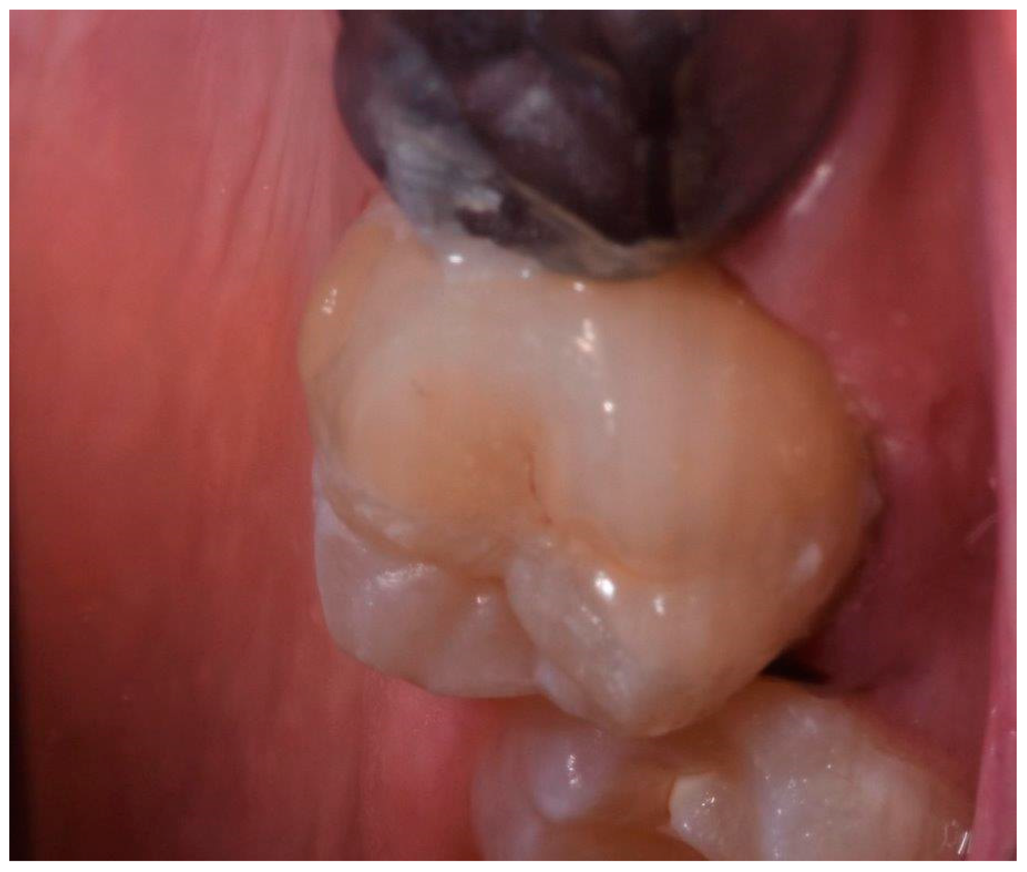 Ijerph 17 01364 g006