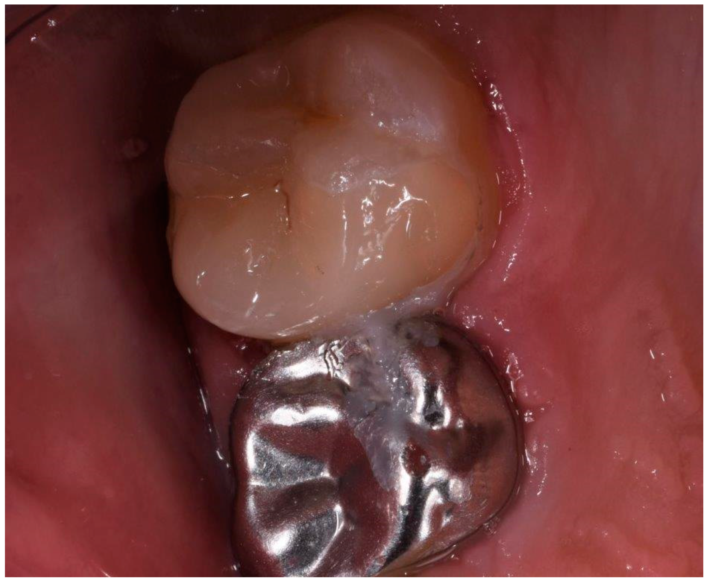 Ijerph 17 01364 g007