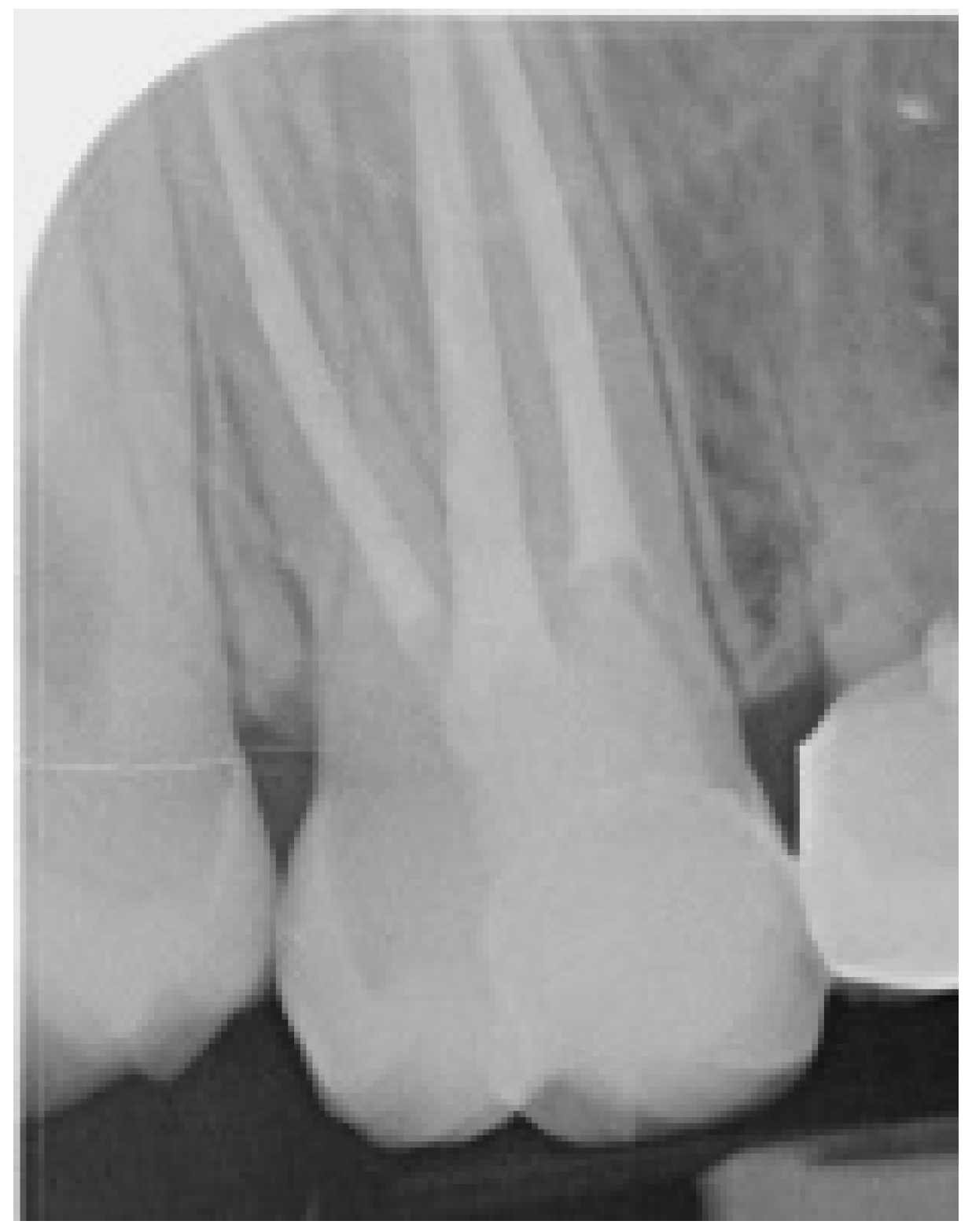 Ijerph 17 01364 g008