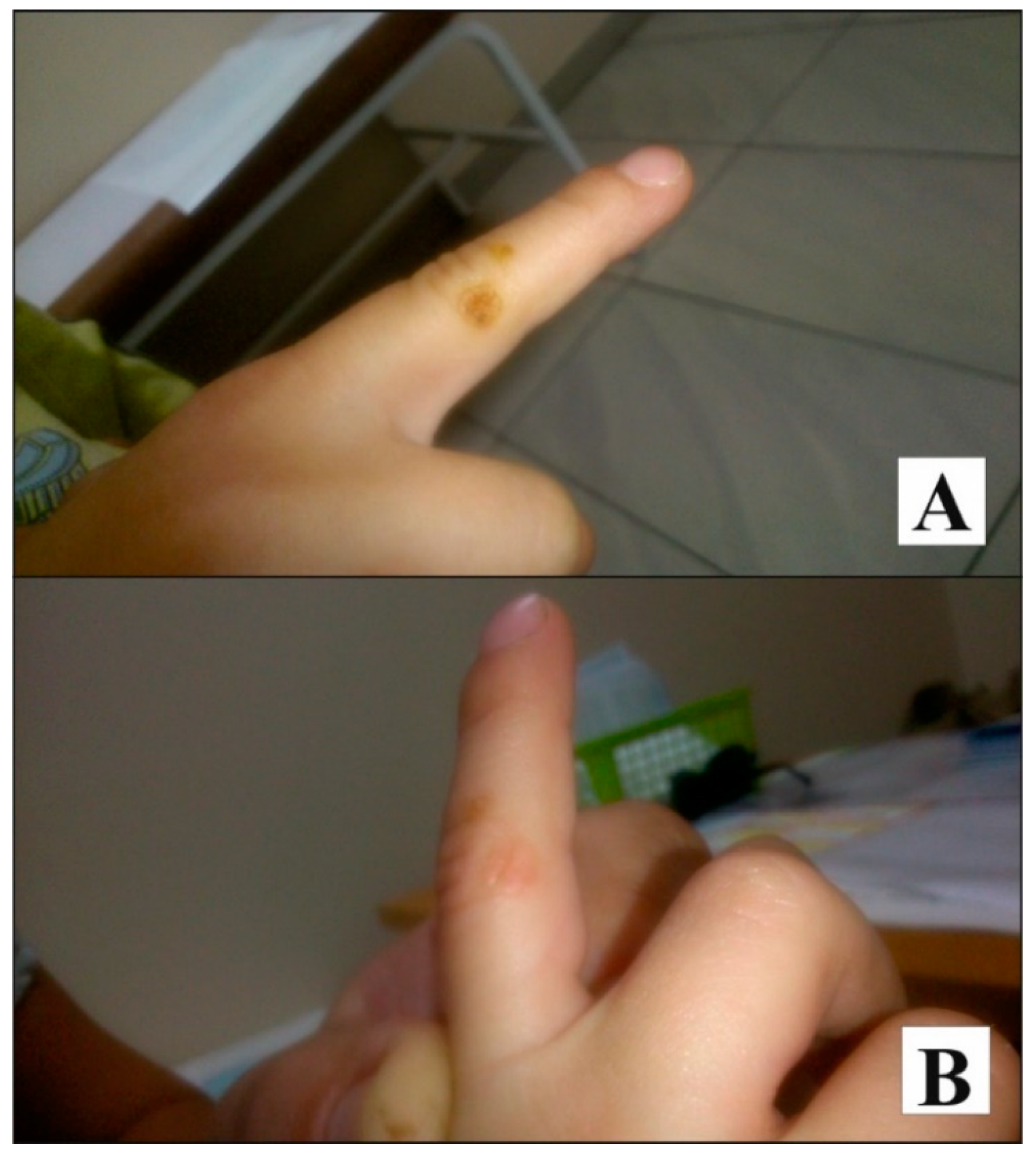 Ijerph 17 01540 g002