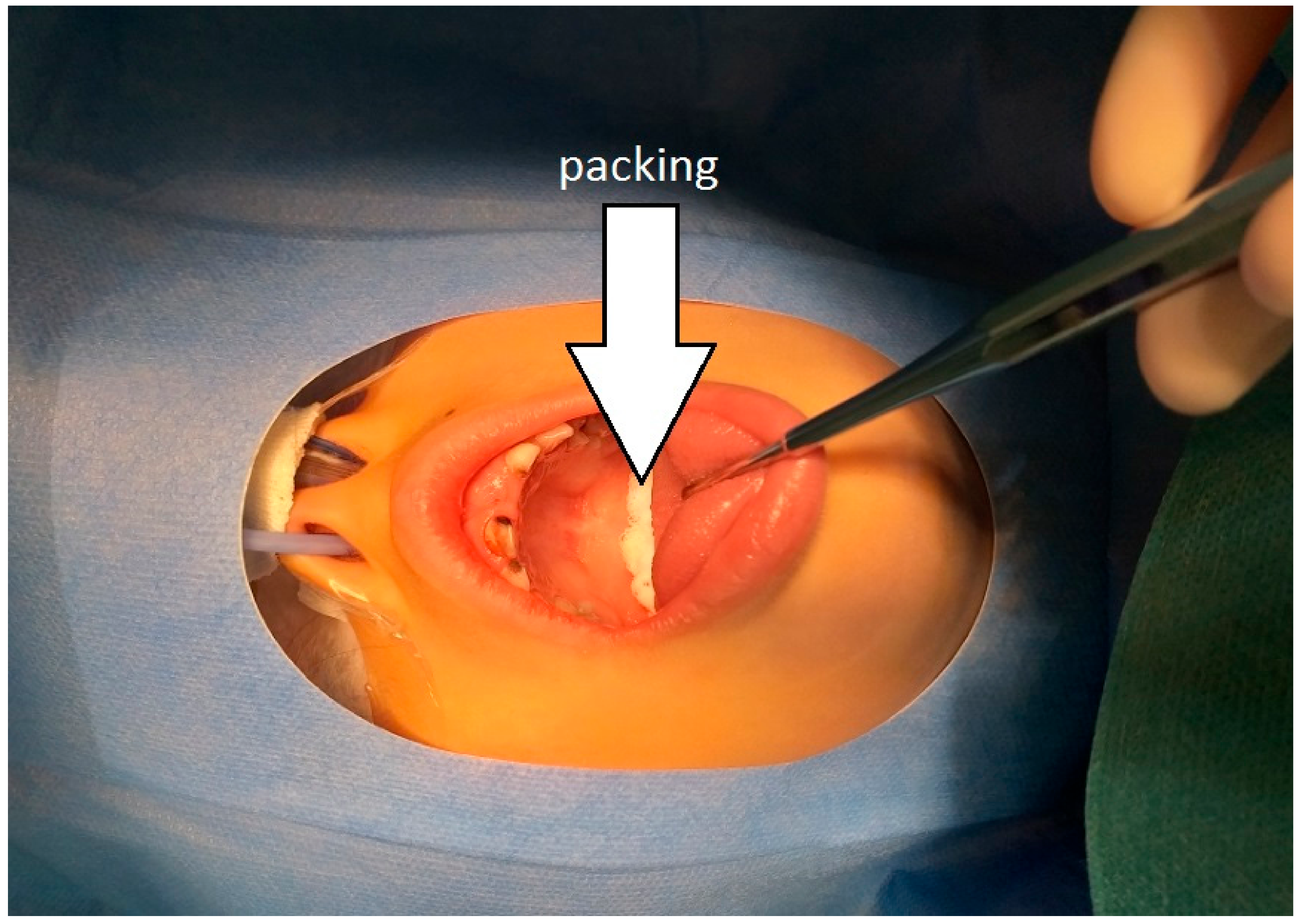 Ijerph 17 01603 g002